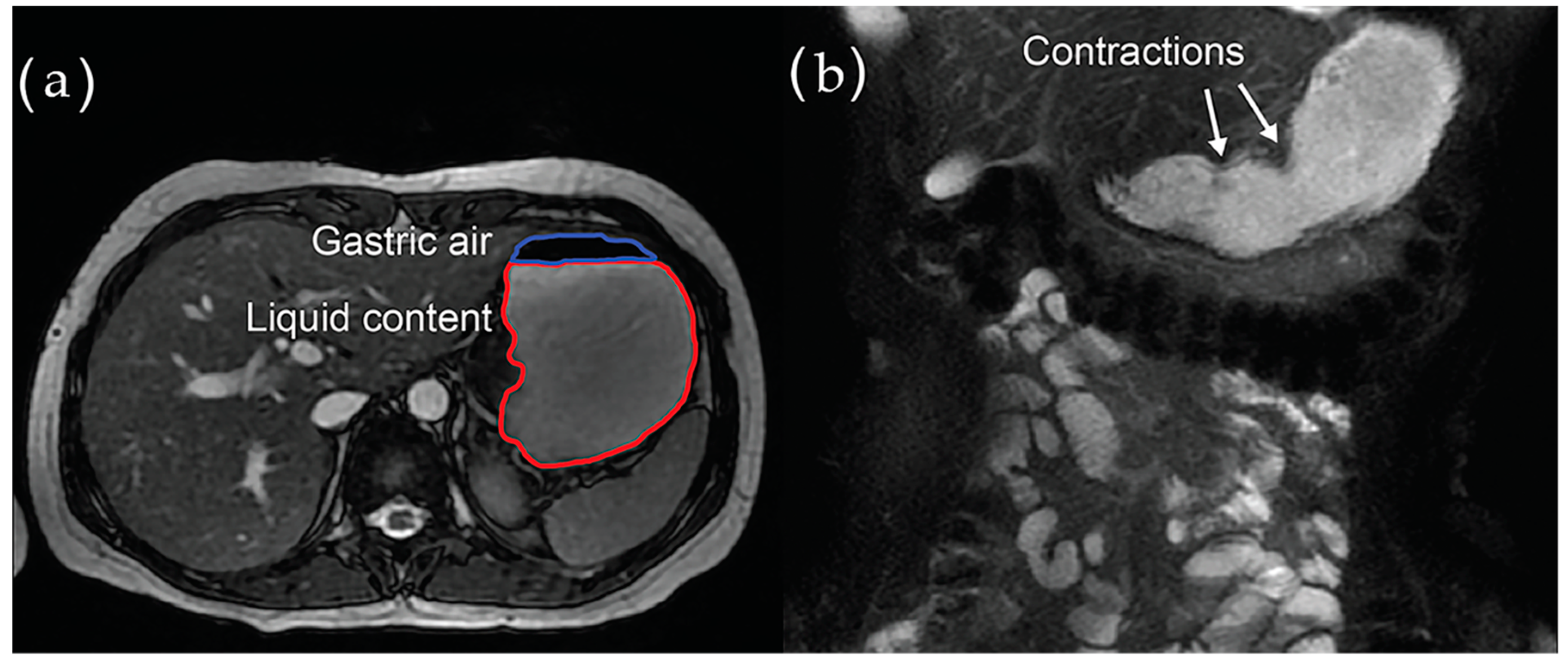Jcm 10 01392 g004 Jcm 10 01392 g004