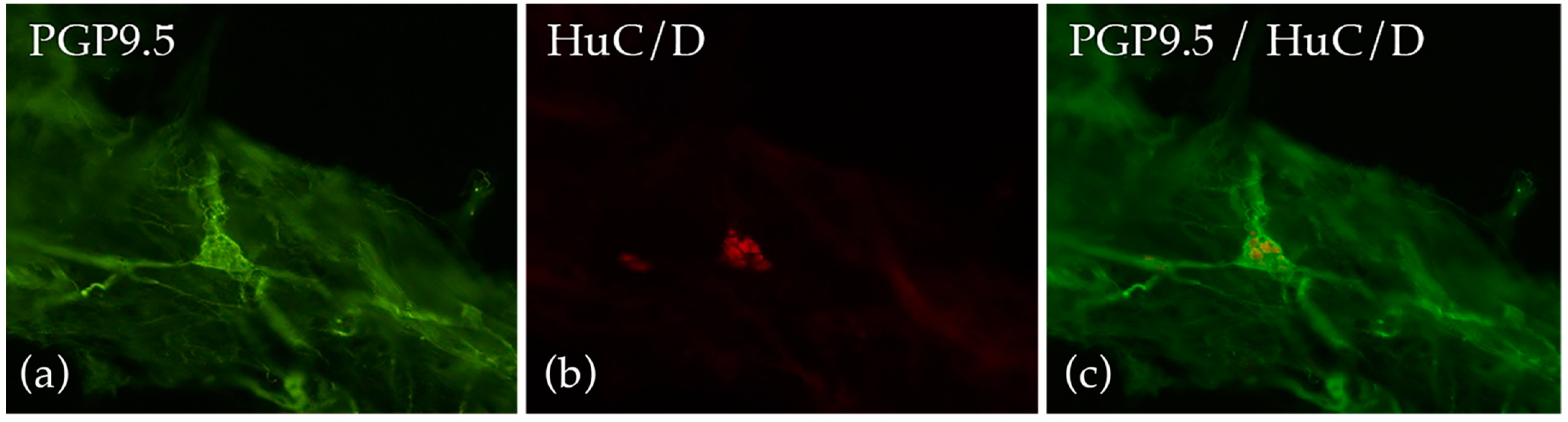 Jcm 10 01392 g006 Jcm 10 01392 g006