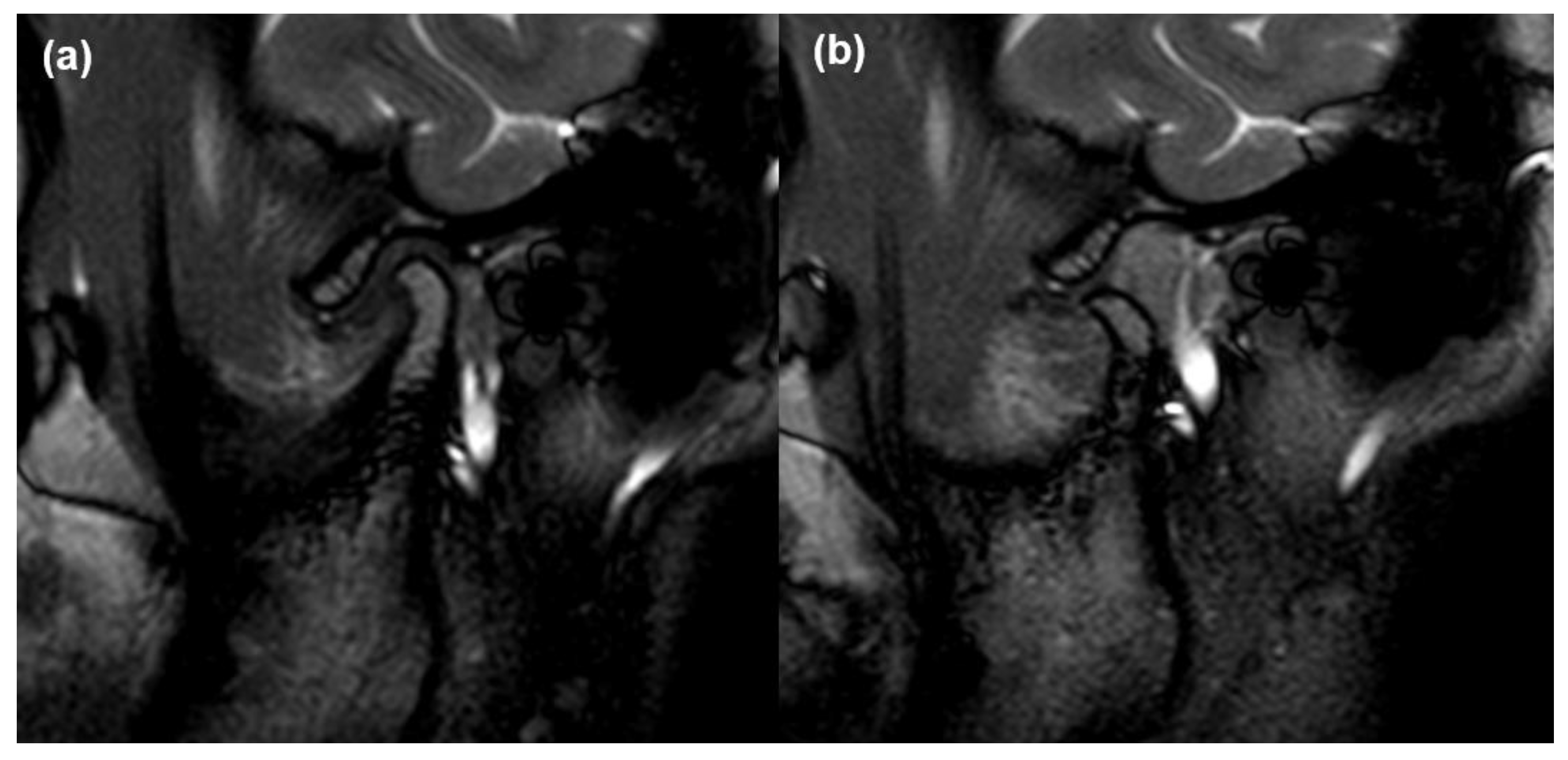 Jcm 10 01404 g004 Jcm 10 01404 g004