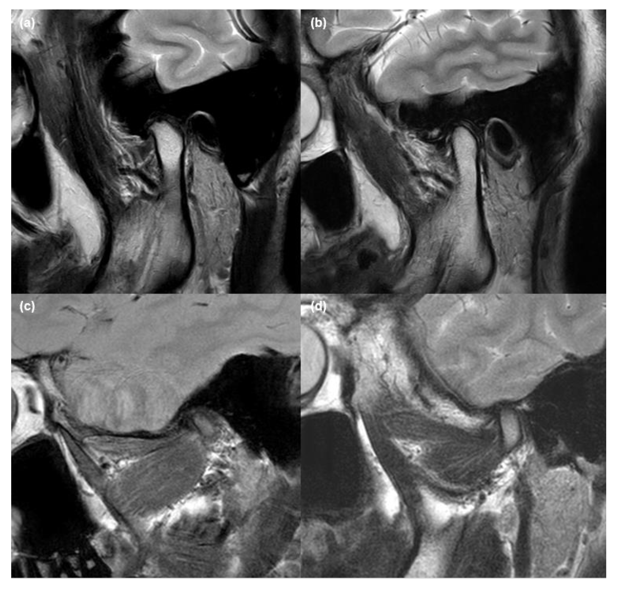 Jcm 10 01404 g006 Jcm 10 01404 g006