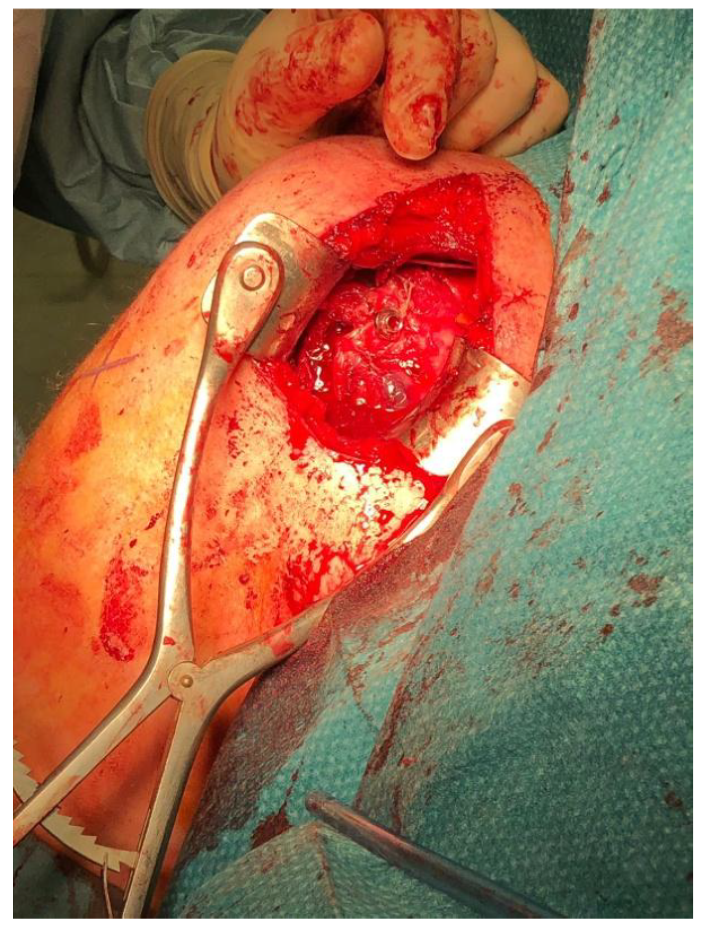 Jcm 10 01410 g004 Jcm 10 01410 g004