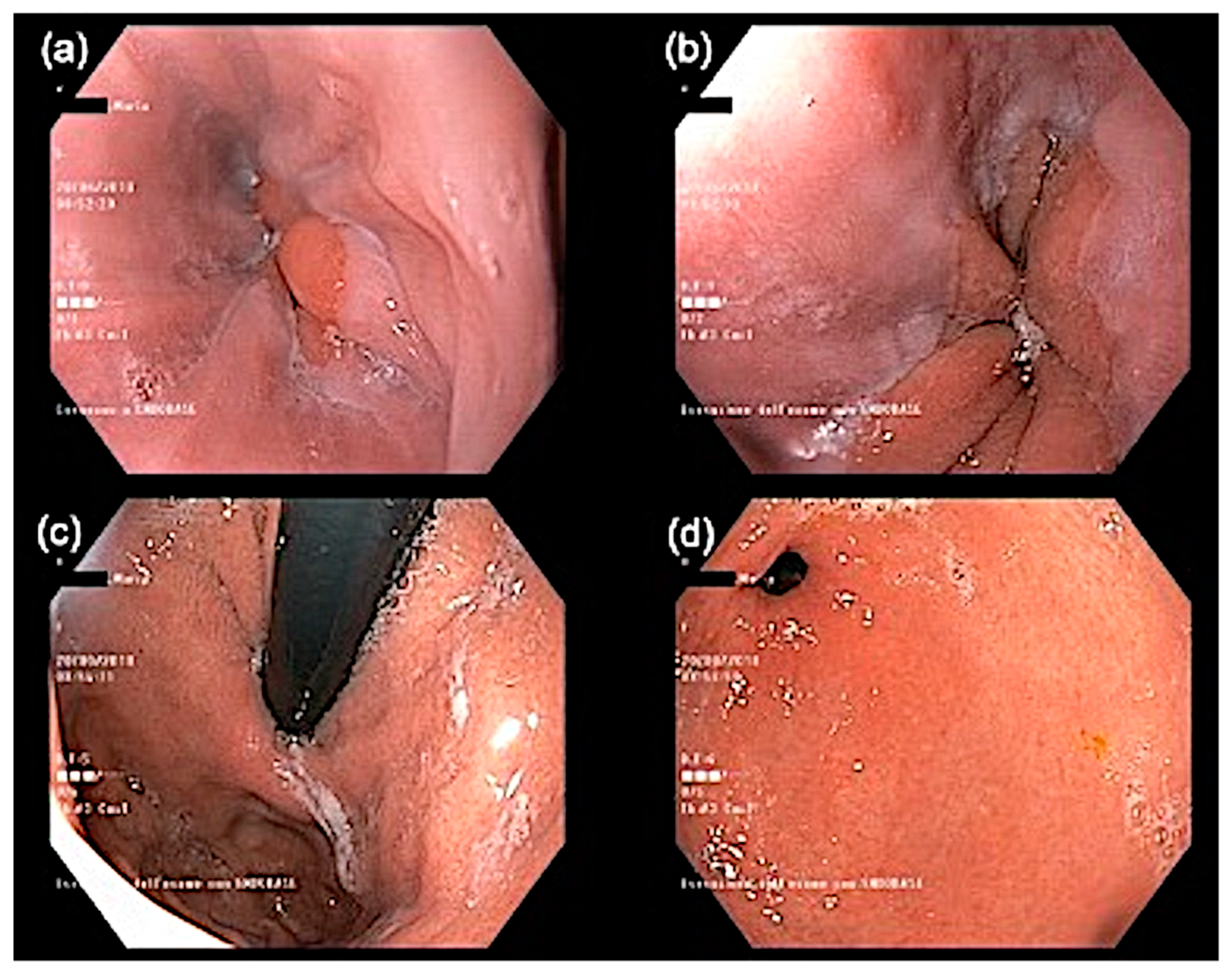 Jcm 10 01442 g002 Jcm 10 01442 g002