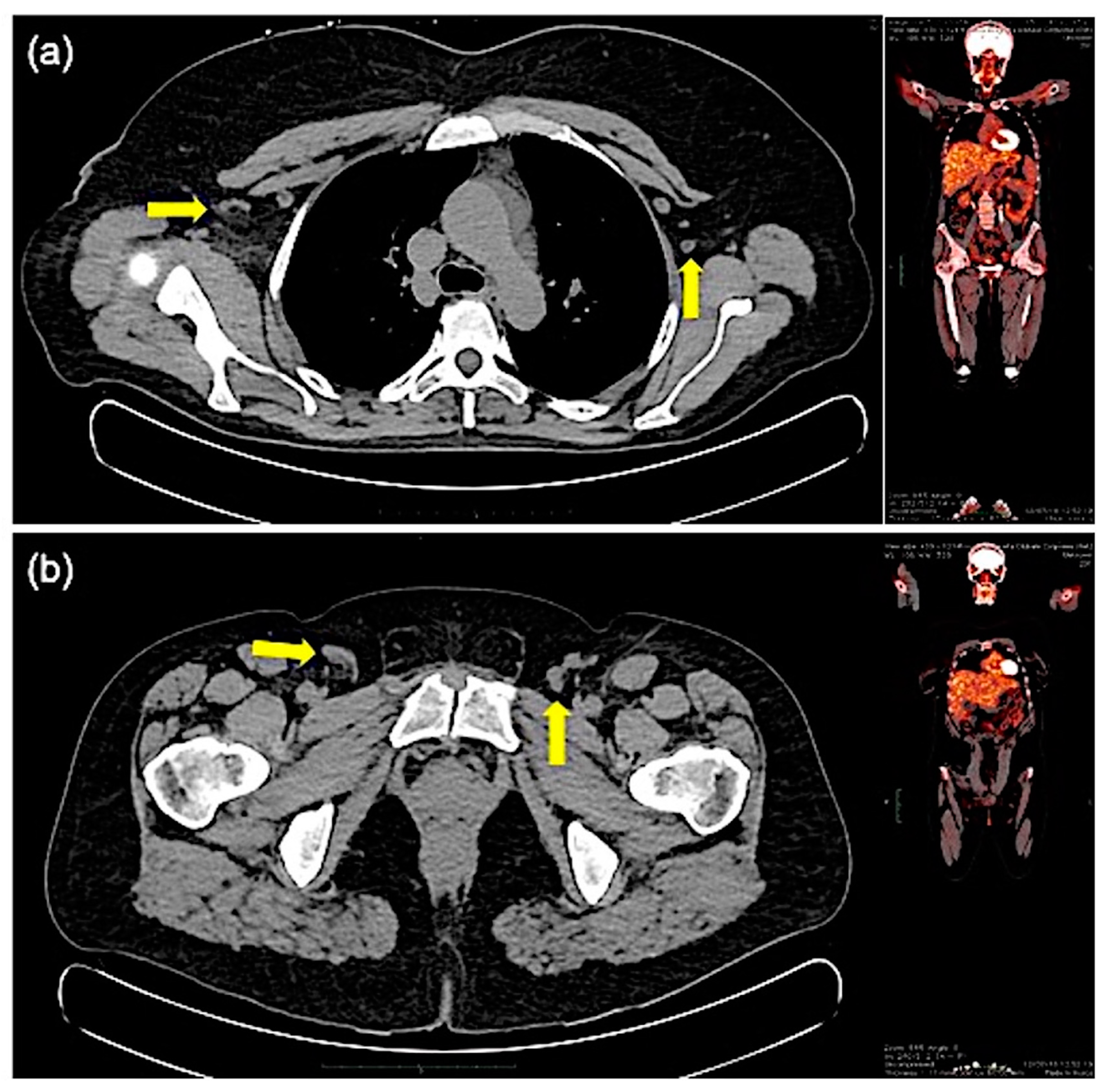 Jcm 10 01442 g003 Jcm 10 01442 g003