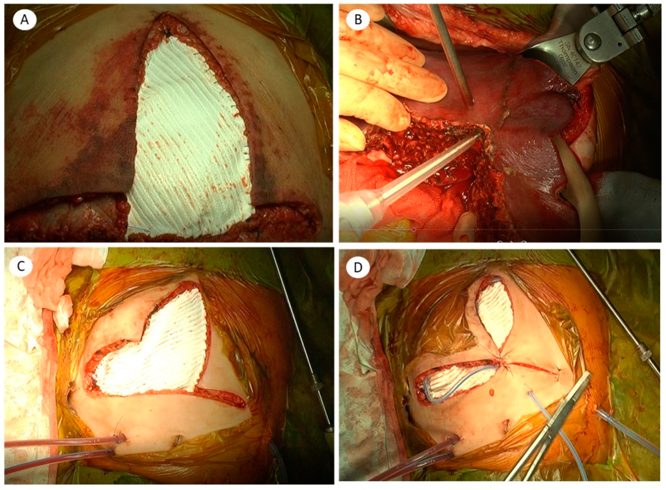 Jcm 10 01462 g001 Jcm 10 01462 g001