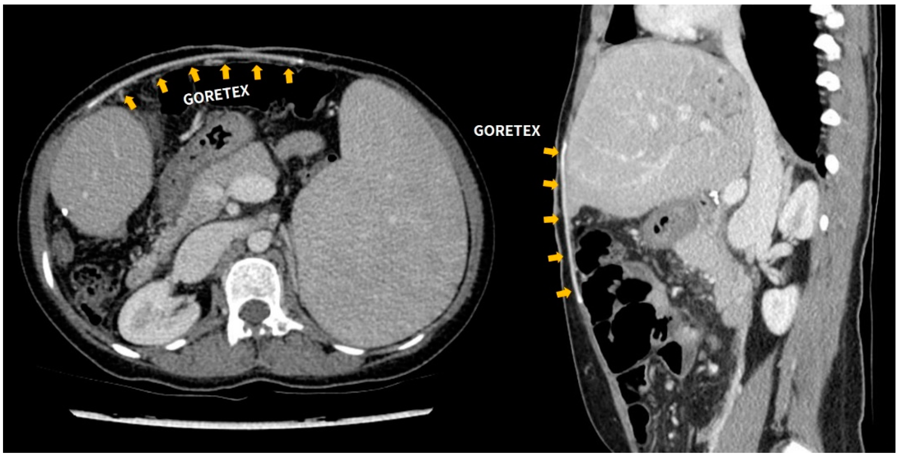 Jcm 10 01462 g002 Jcm 10 01462 g002