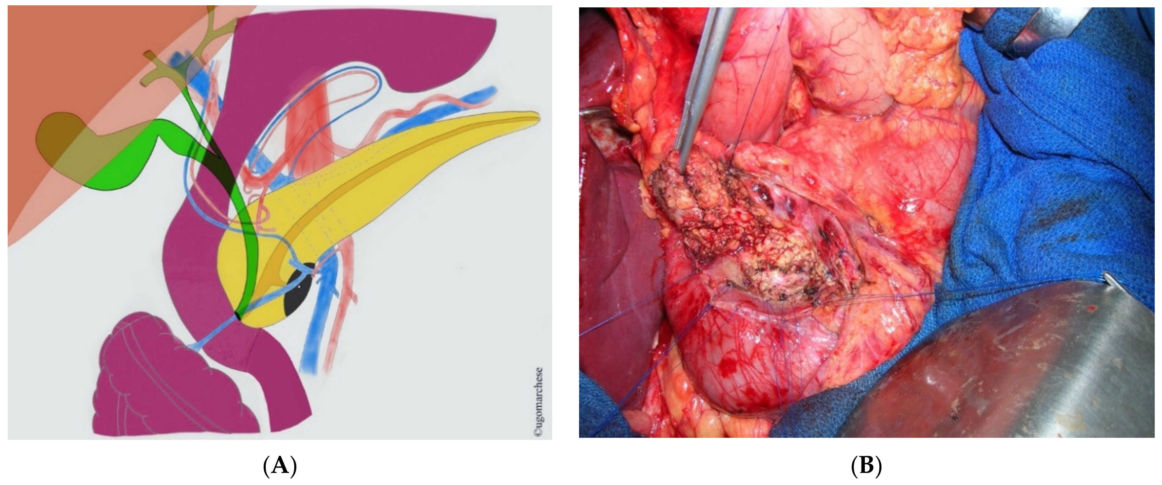 Jcm 10 01479 g003 Jcm 10 01479 g003