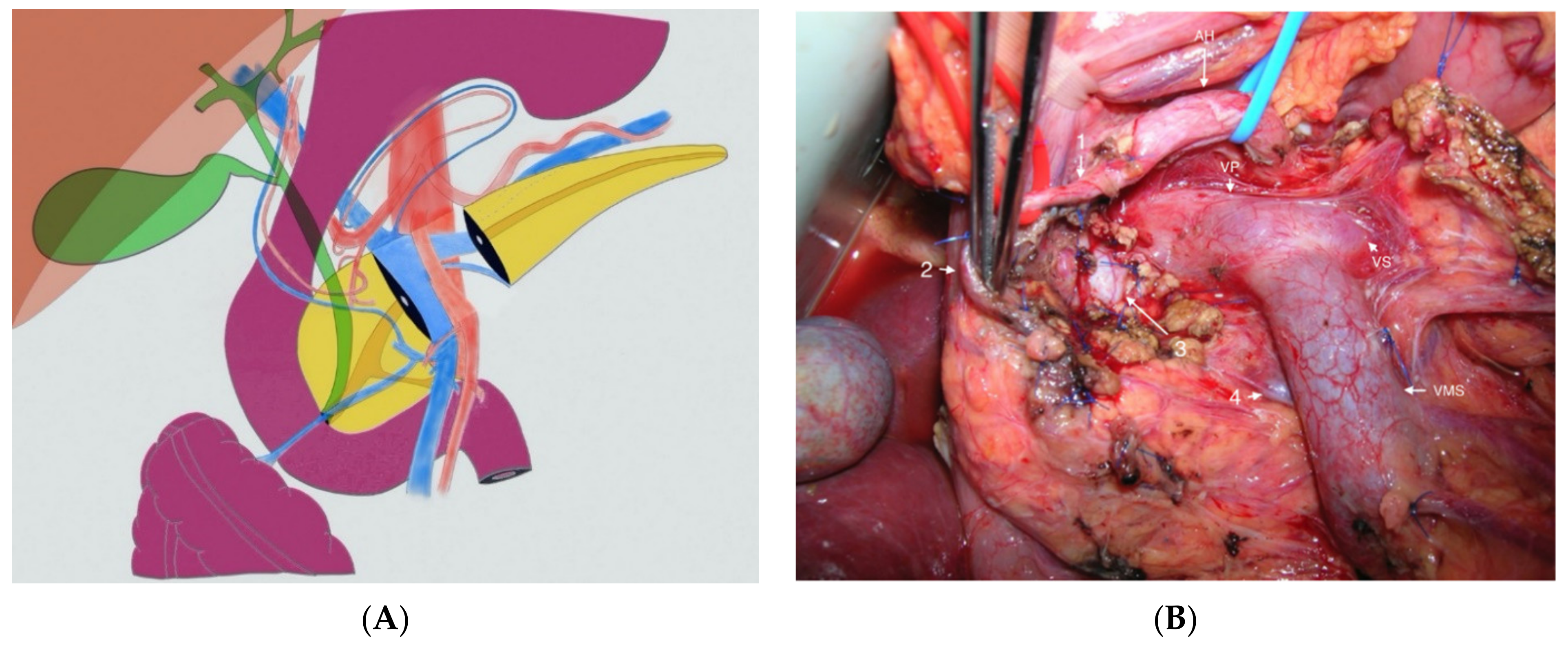 Jcm 10 01479 g004 Jcm 10 01479 g004