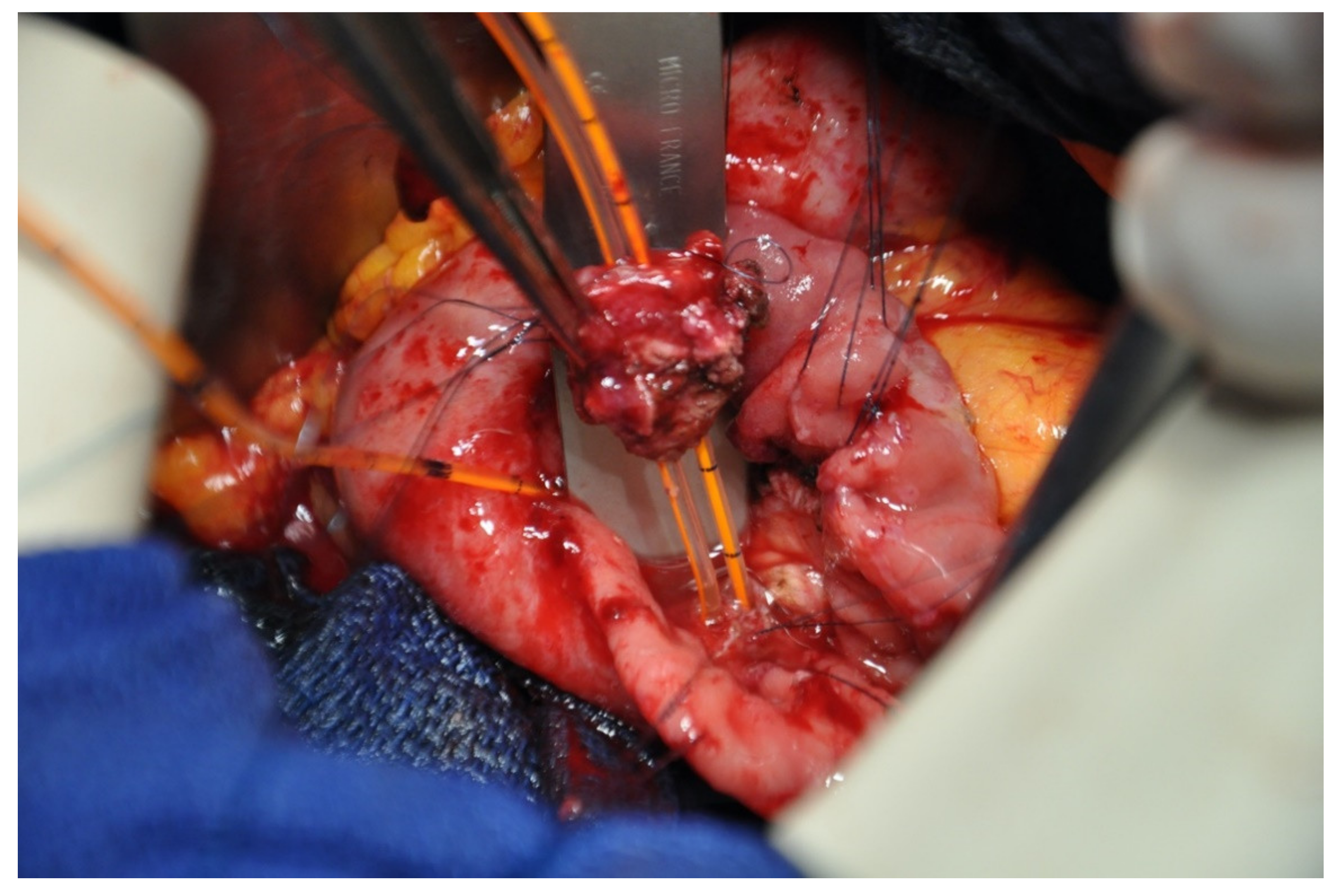 Jcm 10 01479 g005 Jcm 10 01479 g005