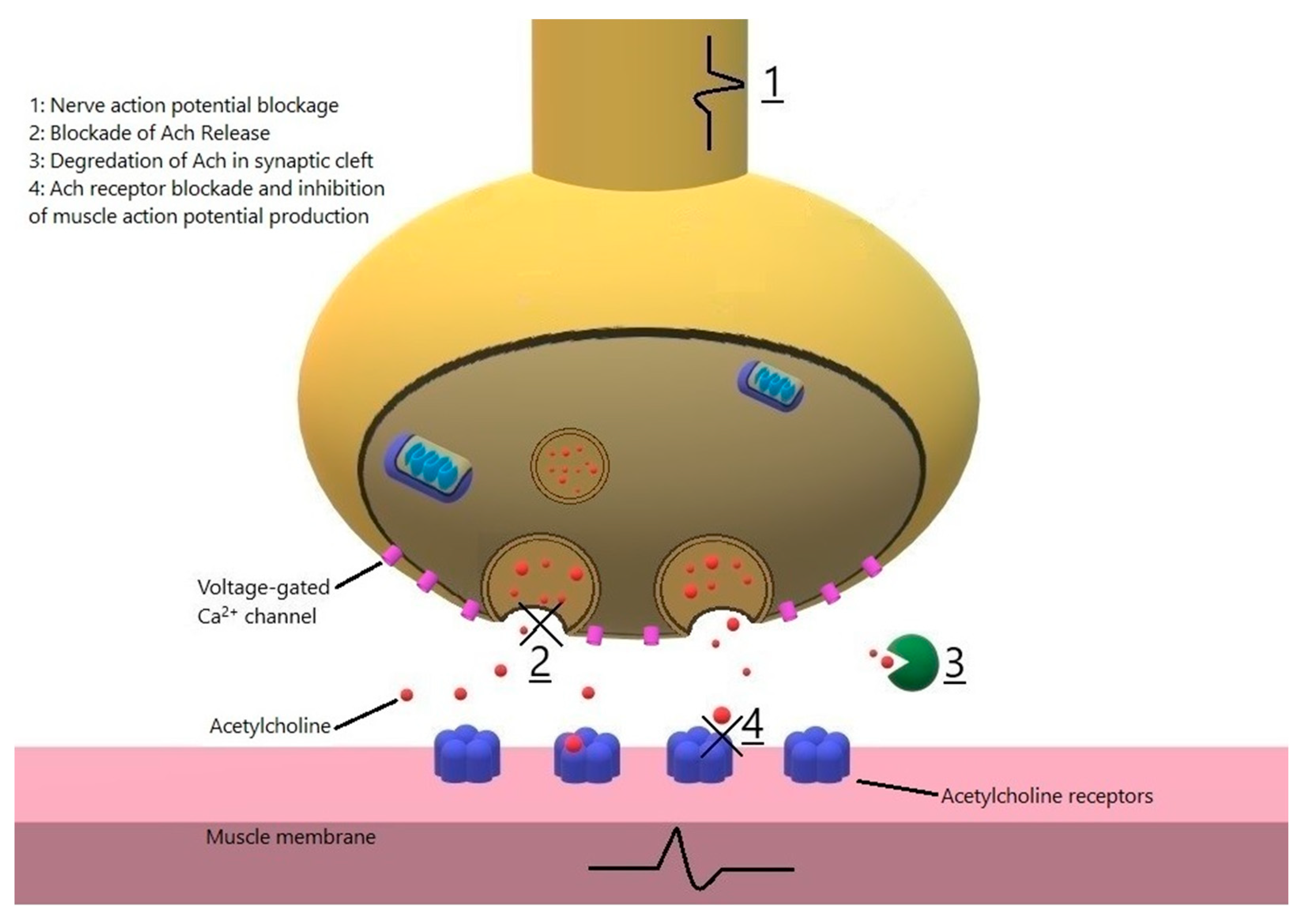 Acetylcholine Receptor Myasthenia Gravis