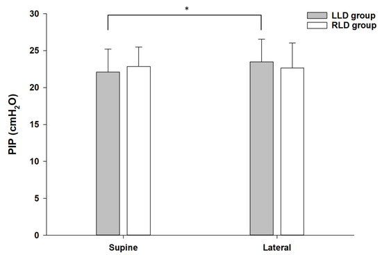 Changes in the Bronchial Cuff Pressure of Left-Sided Double-Lumen ...