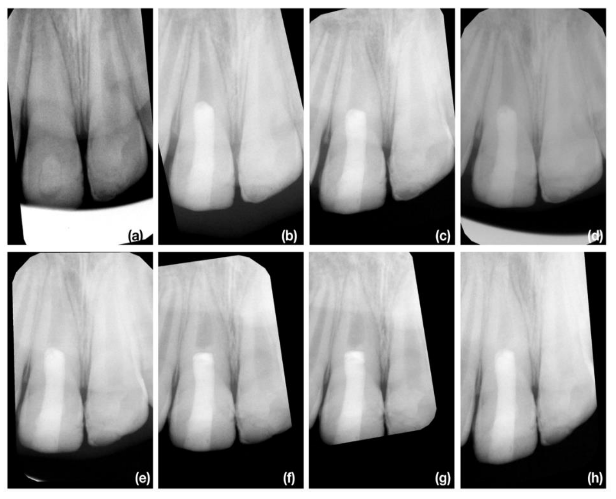 Jcm 10 01600 g007 Jcm 10 01600 g007