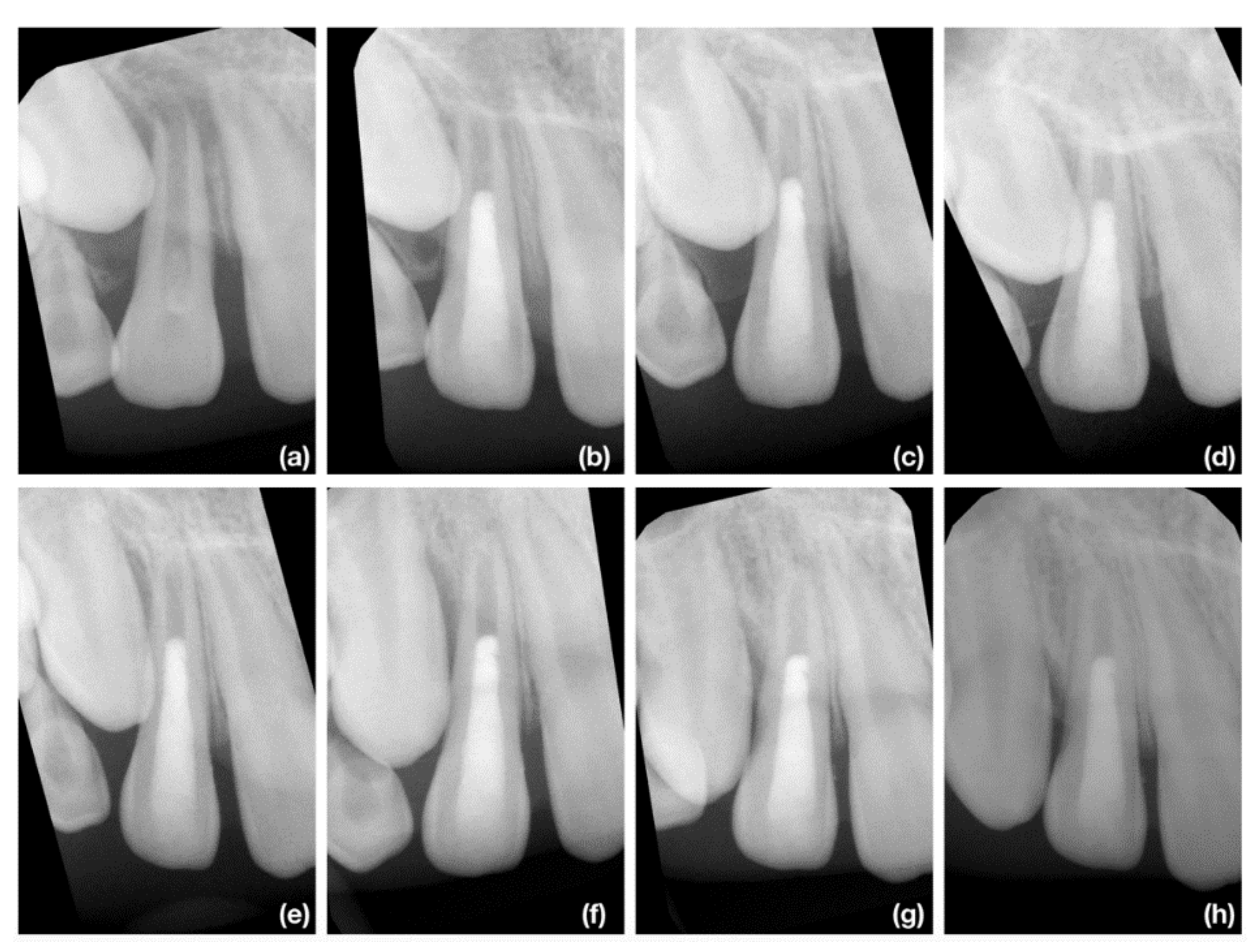 Jcm 10 01600 g008 Jcm 10 01600 g008