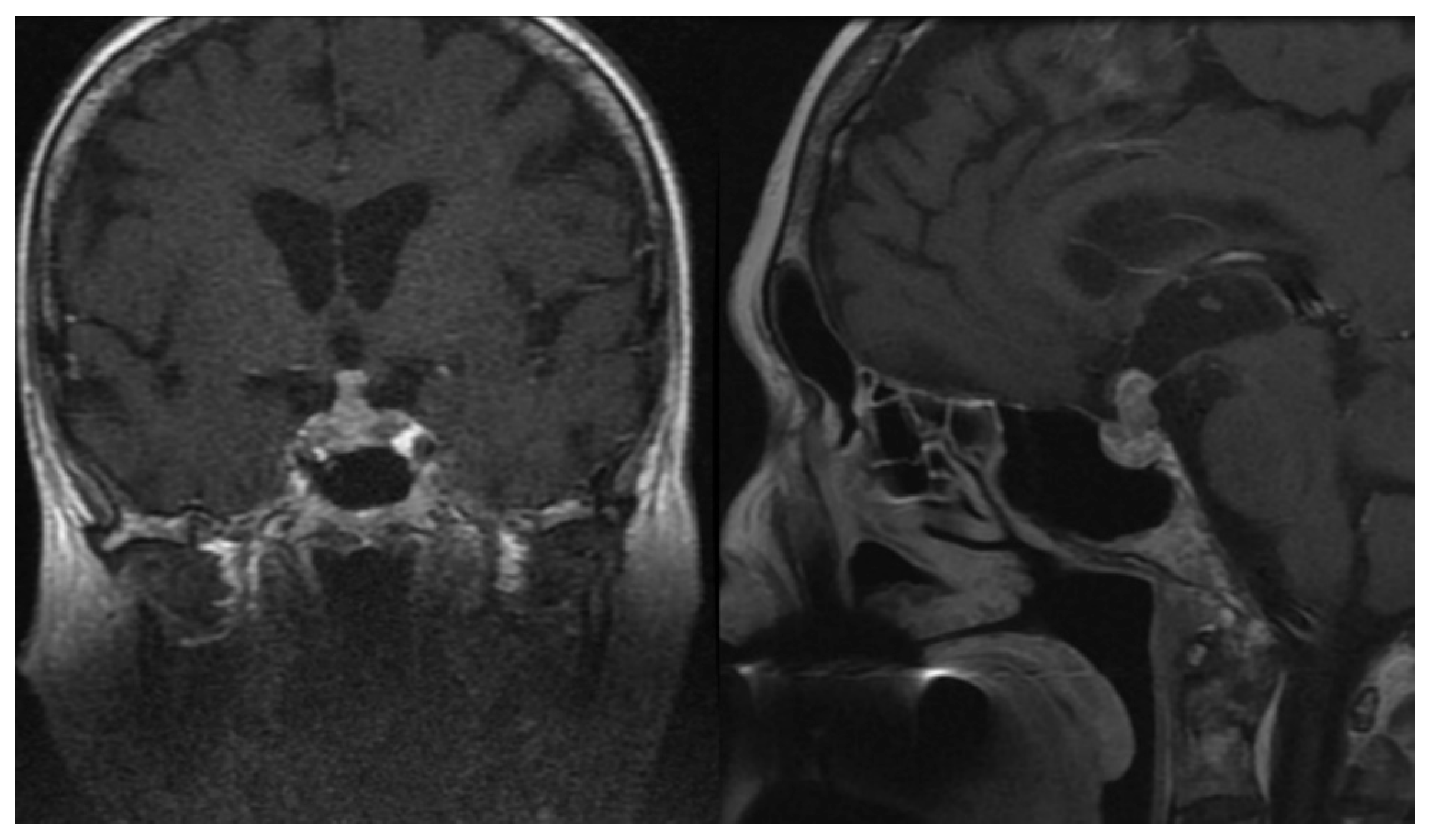 Jcm 10 01692 g004 Jcm 10 01692 g004