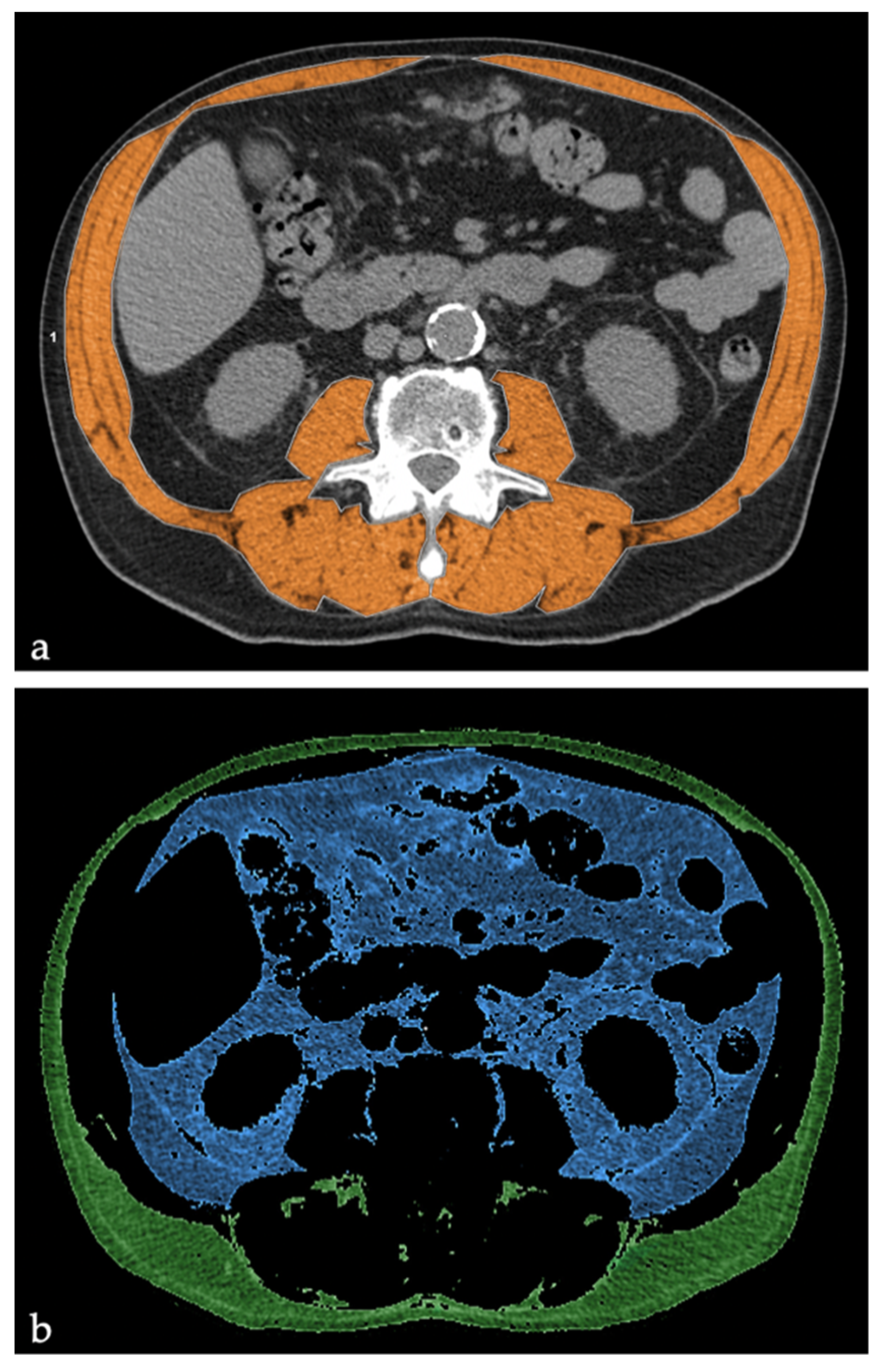 Jcm 10 01705 g001 Jcm 10 01705 g001