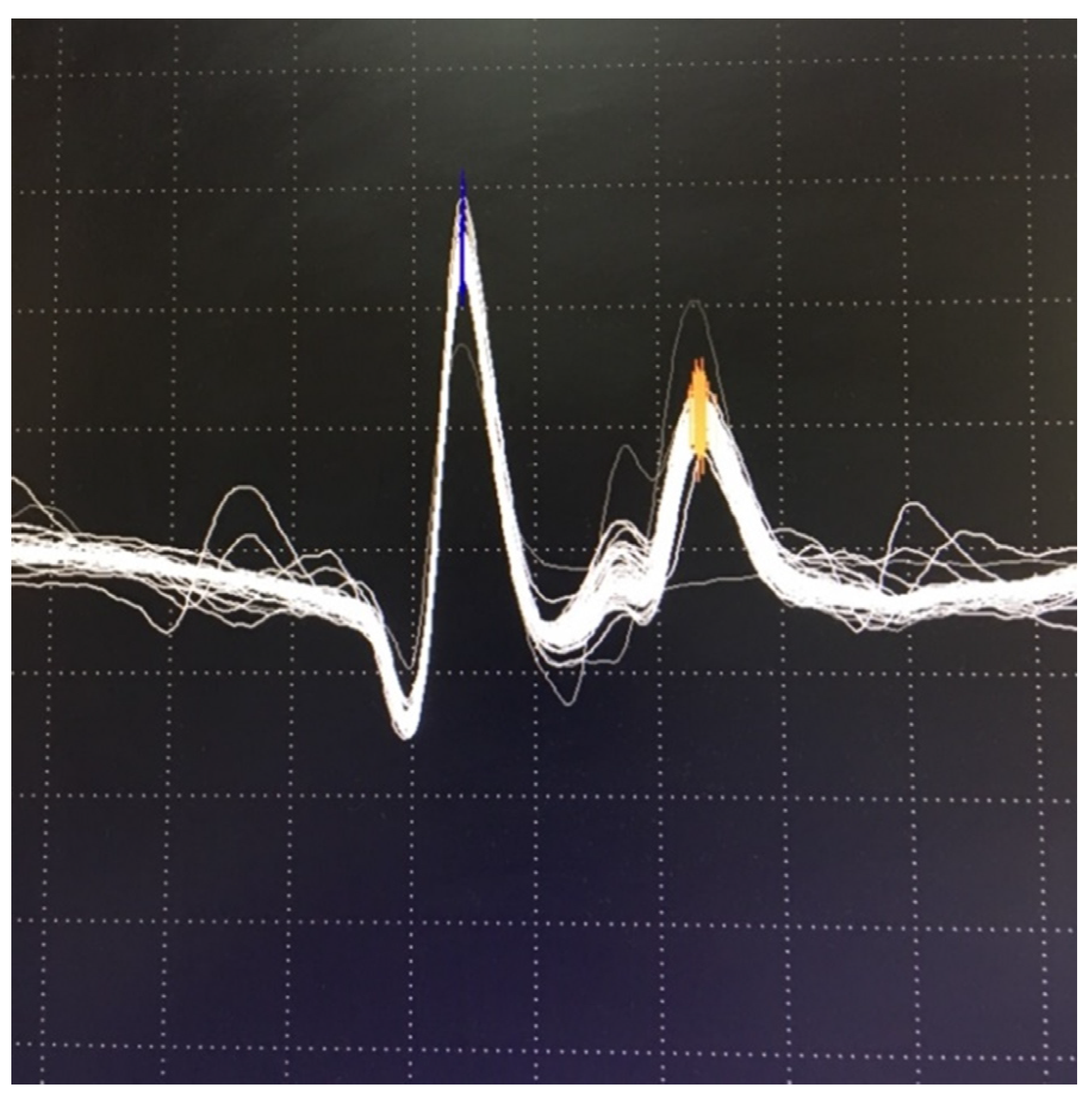 Jcm 10 01736 g007