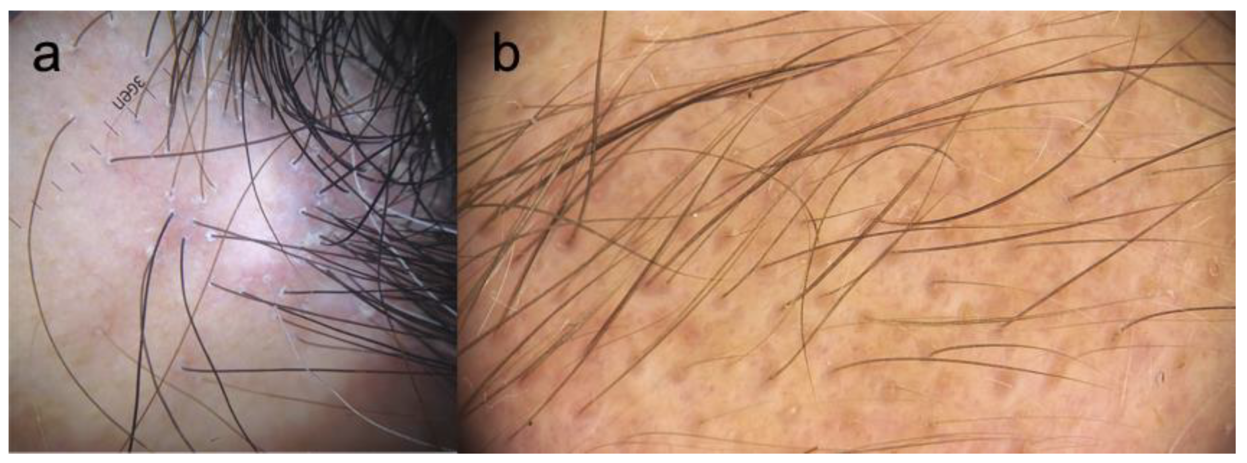 Jcm 10 01805 g004 Jcm 10 01805 g004