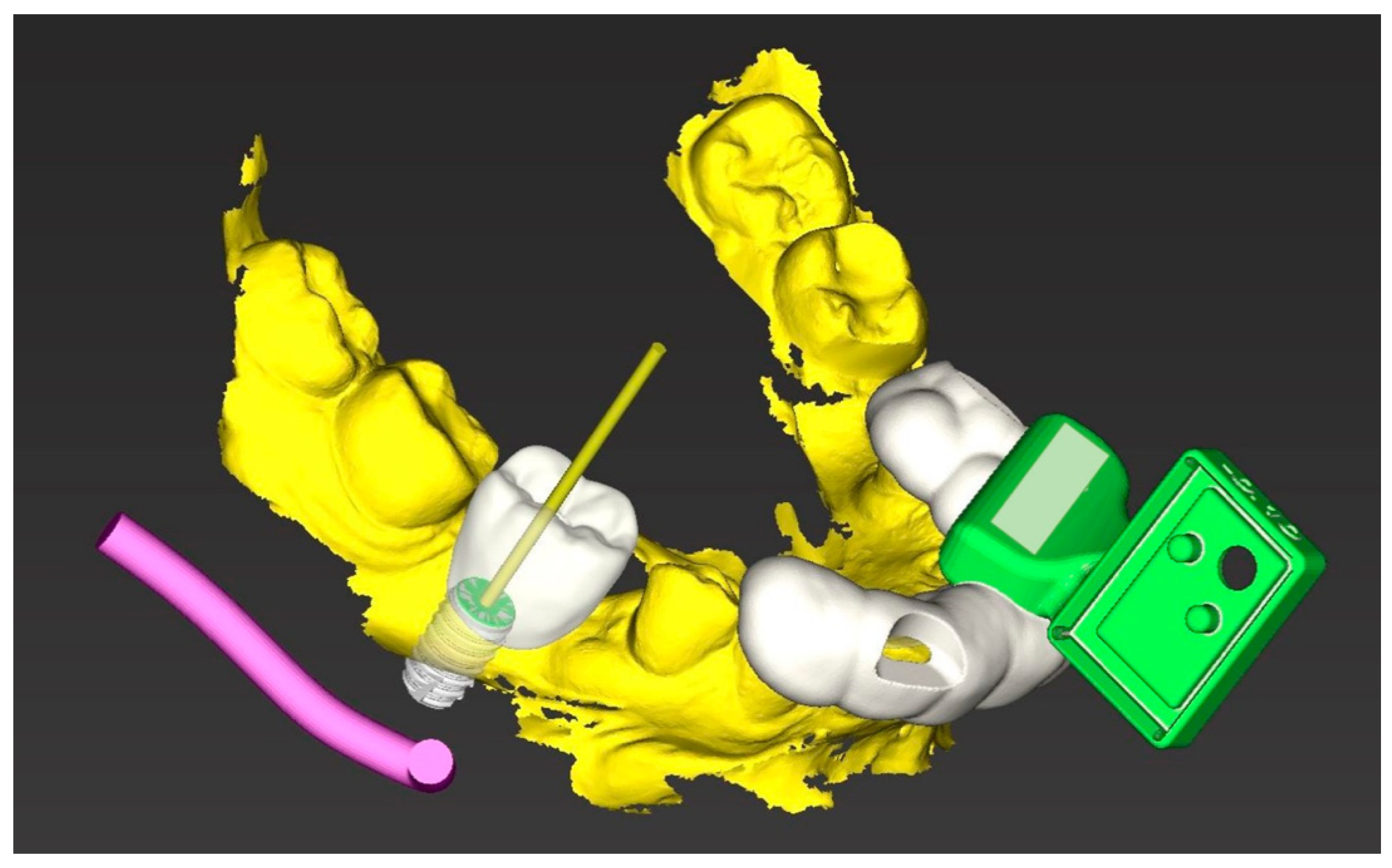 Jcm 10 01808 g001 Jcm 10 01808 g001