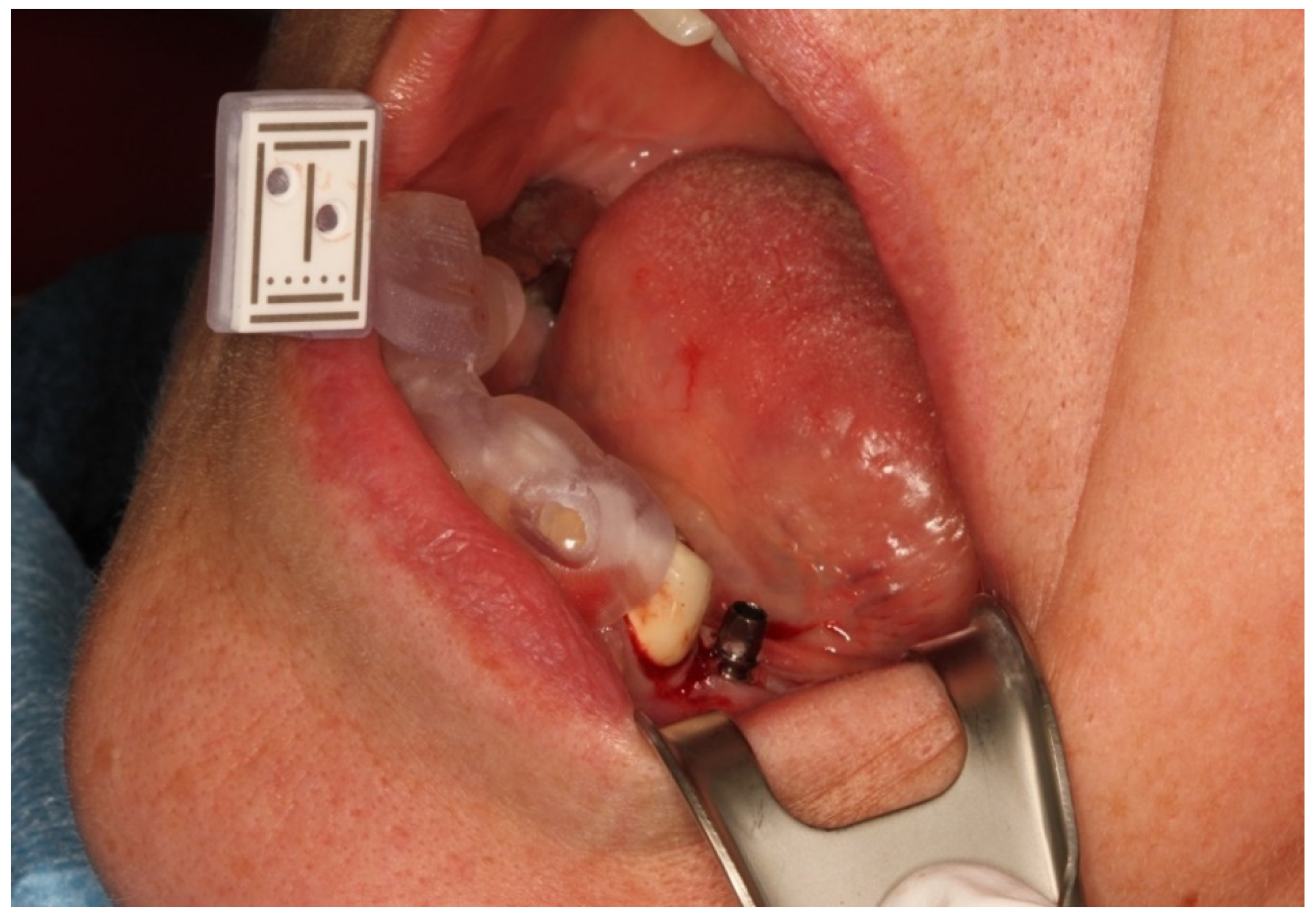 Jcm 10 01808 g003 Jcm 10 01808 g003