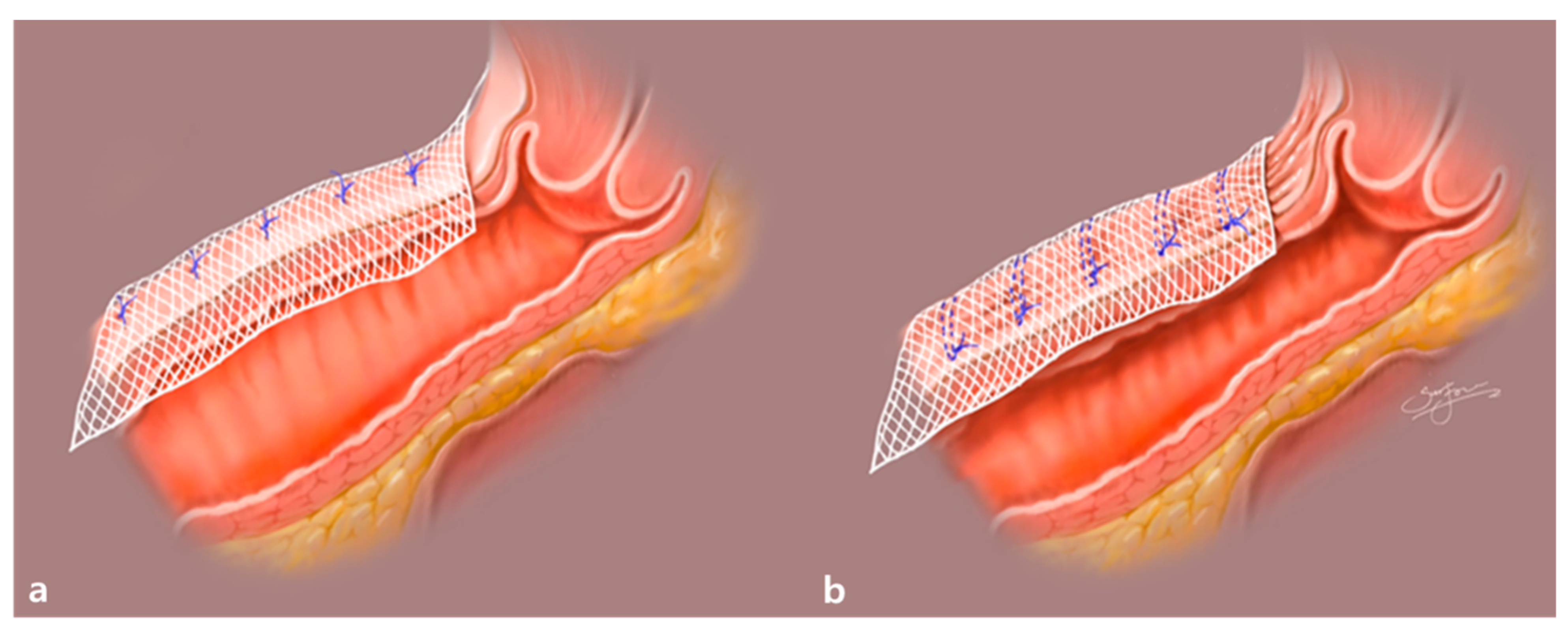 Jcm 10 01822 g002 Jcm 10 01822 g002