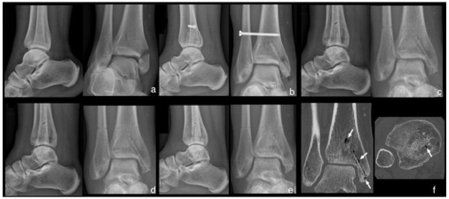 Jcm 10 01842 g001 Jcm 10 01842 g001