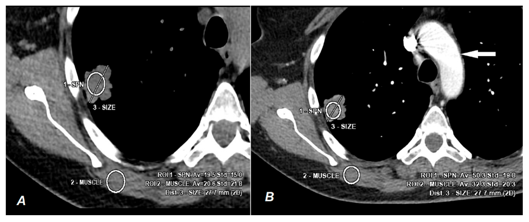 Jcm 10 01870 g001 Jcm 10 01870 g001