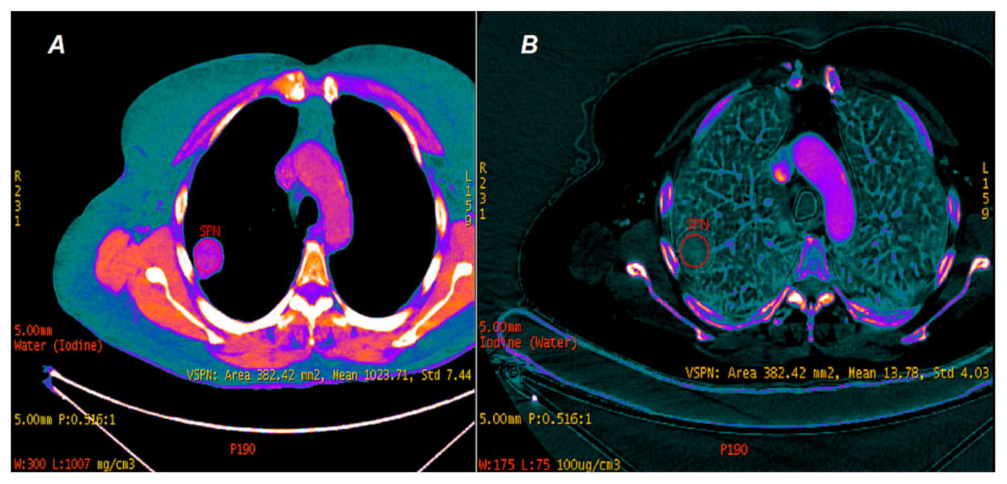Jcm 10 01870 g003 Jcm 10 01870 g003