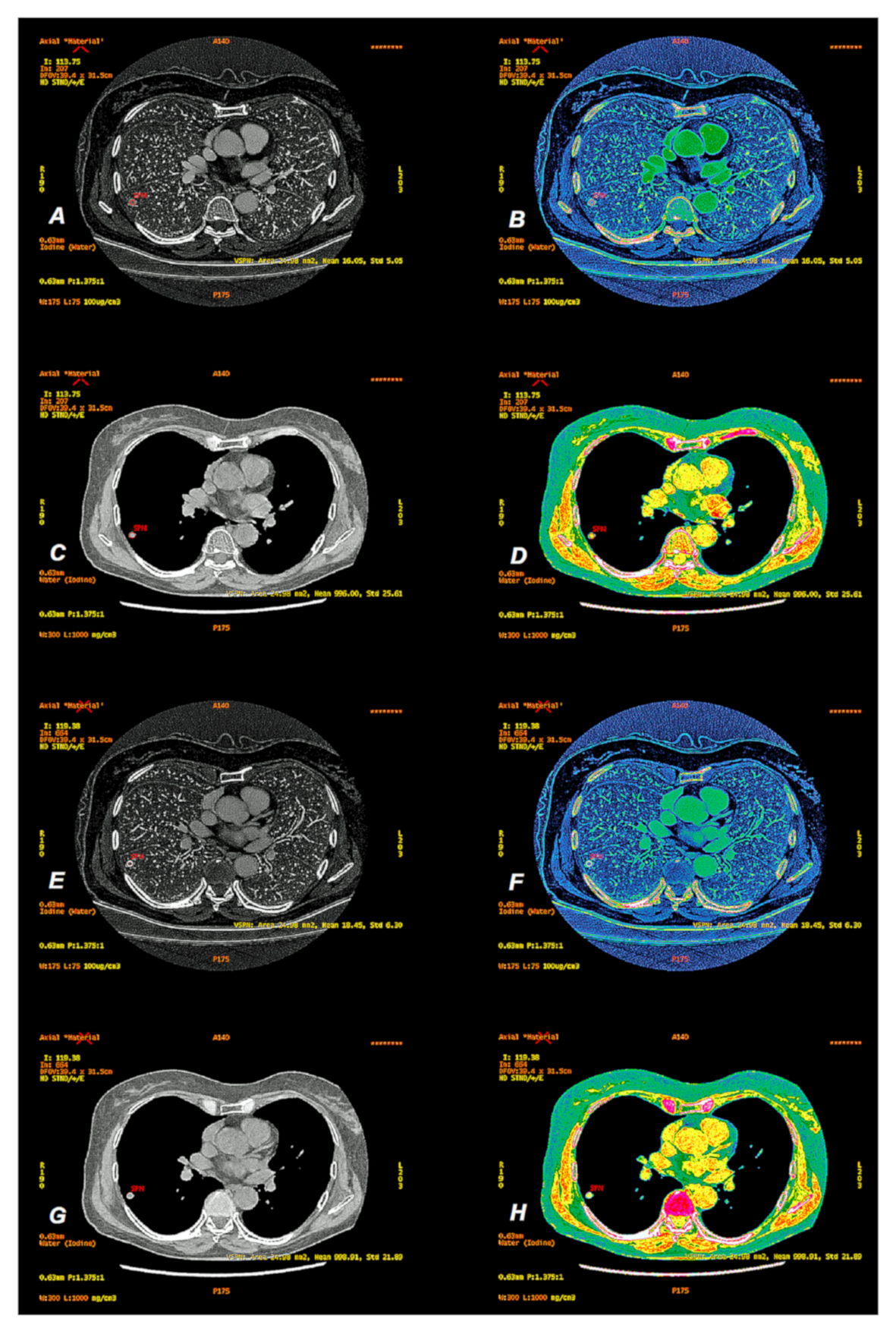 Jcm 10 01870 g005 Jcm 10 01870 g005