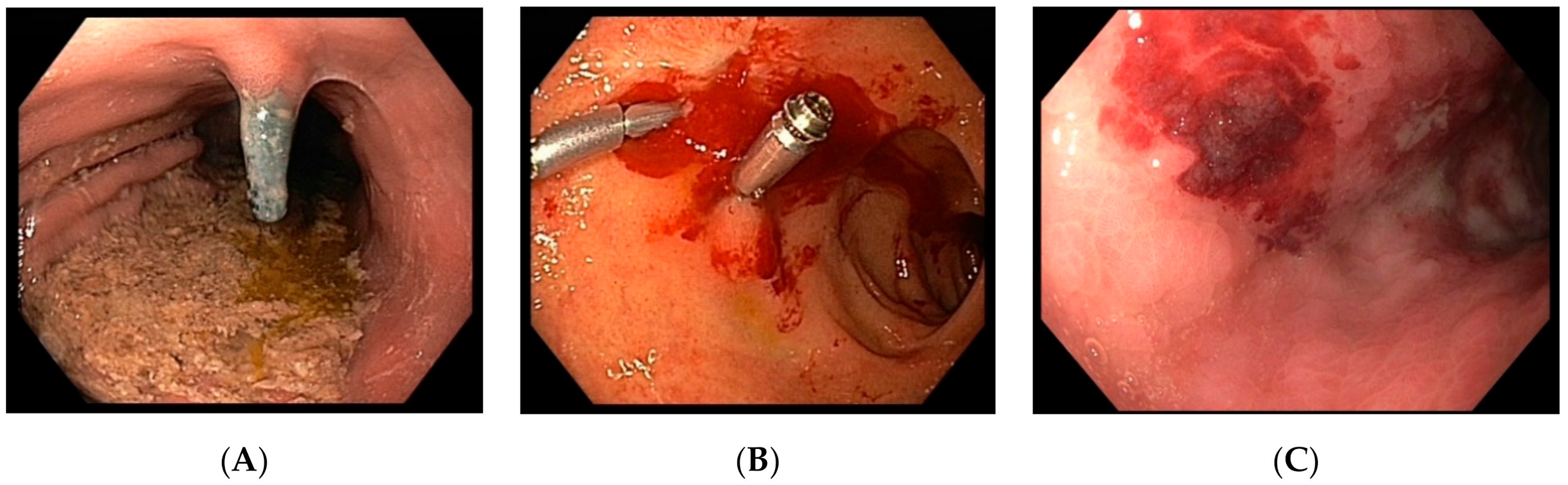 Jcm 10 01925 g001 Jcm 10 01925 g001