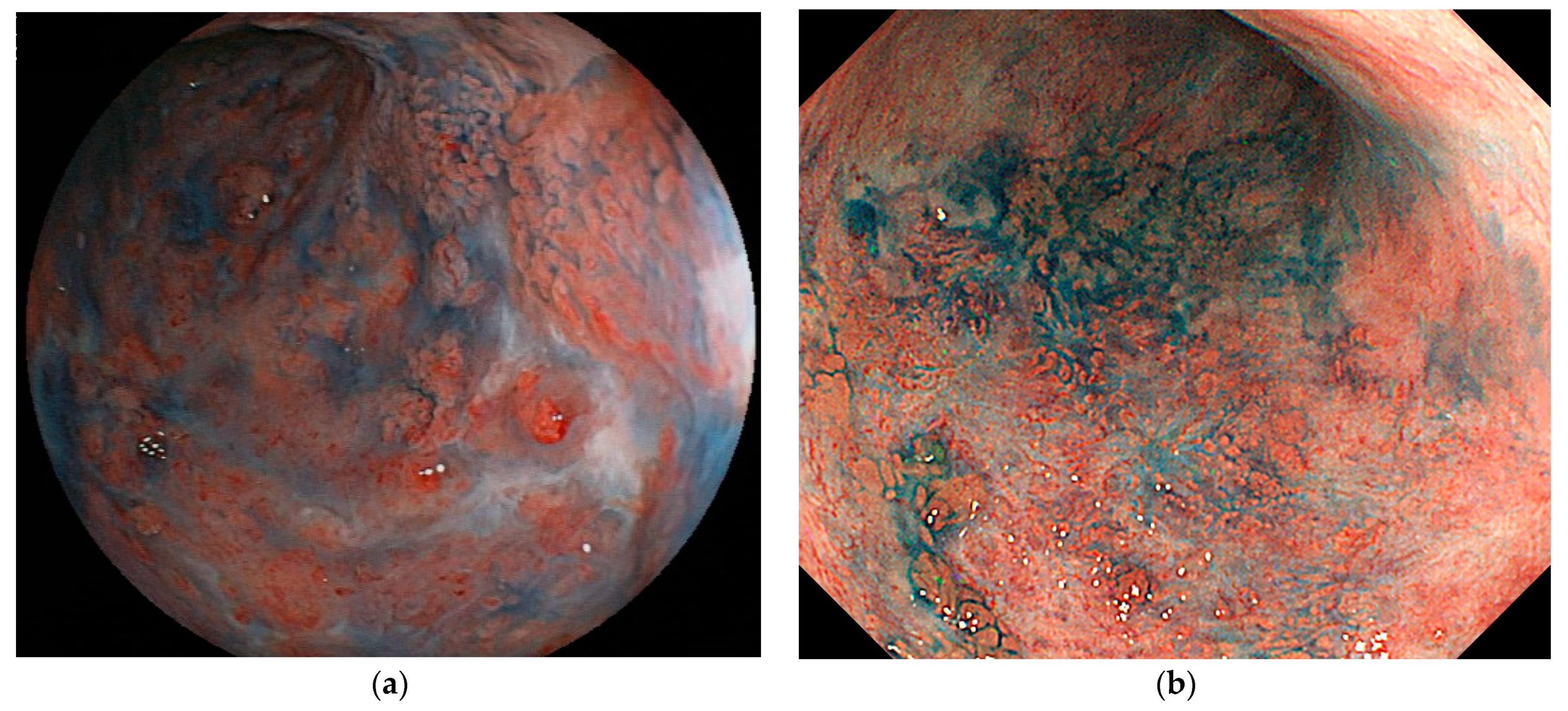 Jcm 10 01927 g001 Jcm 10 01927 g001