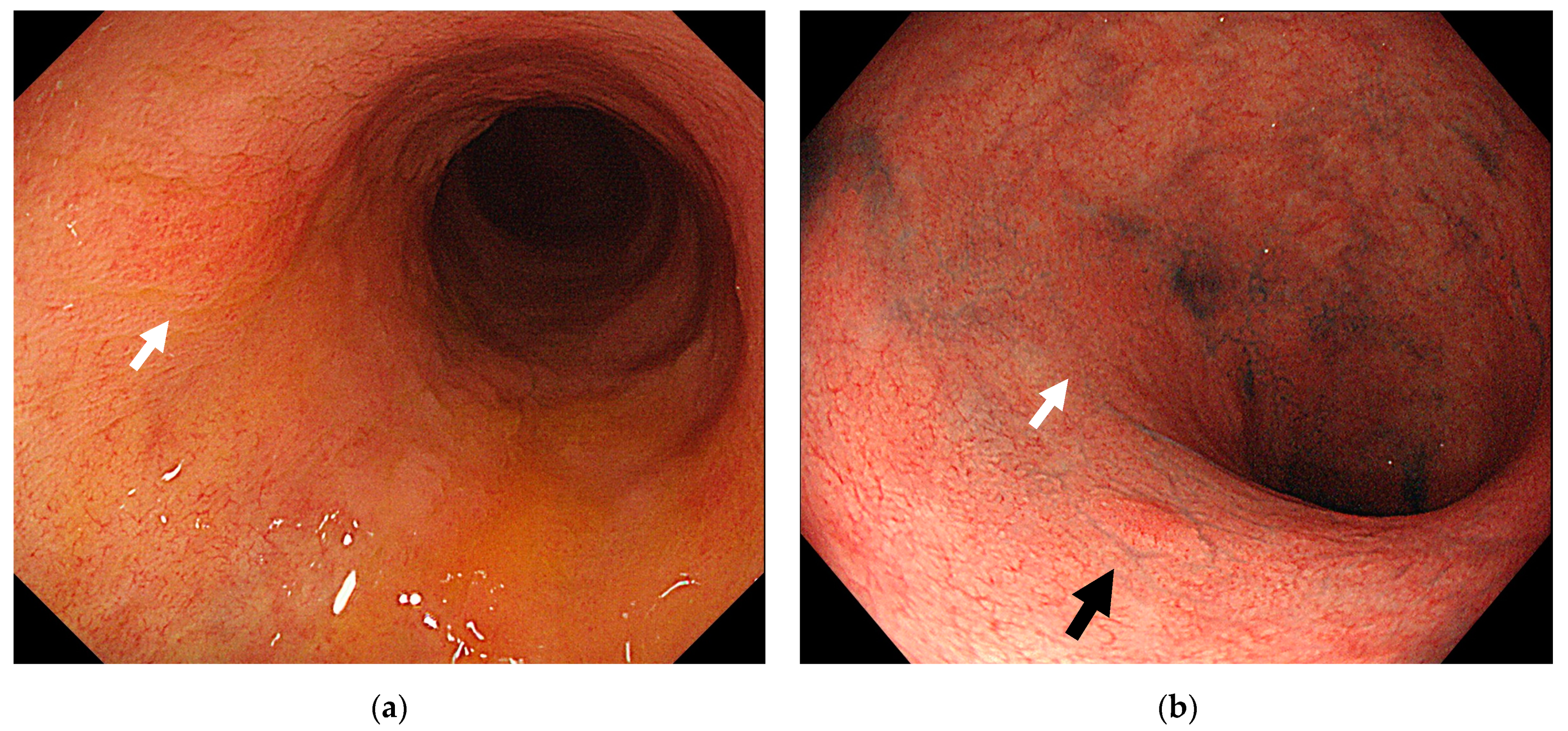 Jcm 10 01927 g003 Jcm 10 01927 g003