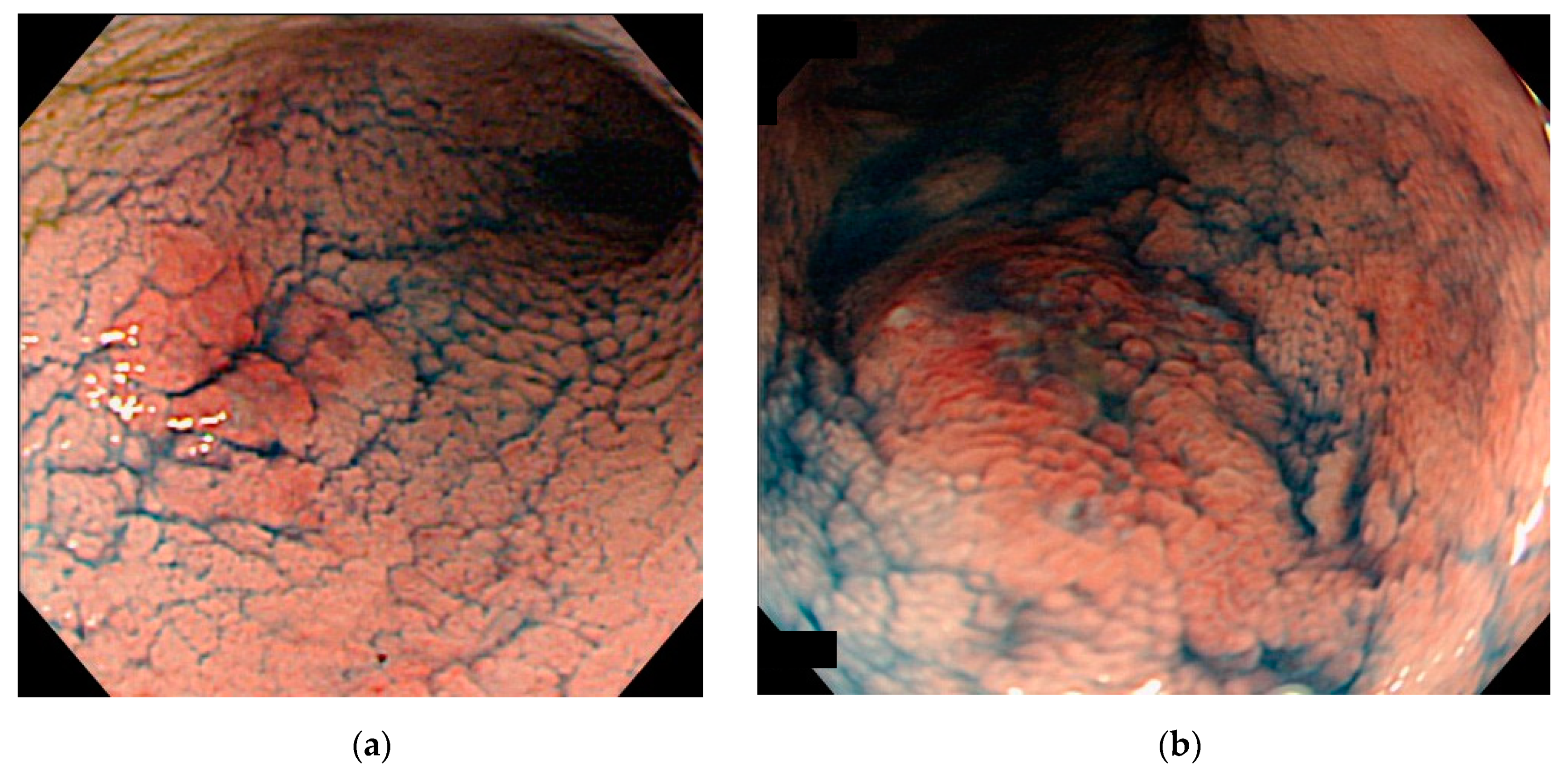 Jcm 10 01927 g004 Jcm 10 01927 g004