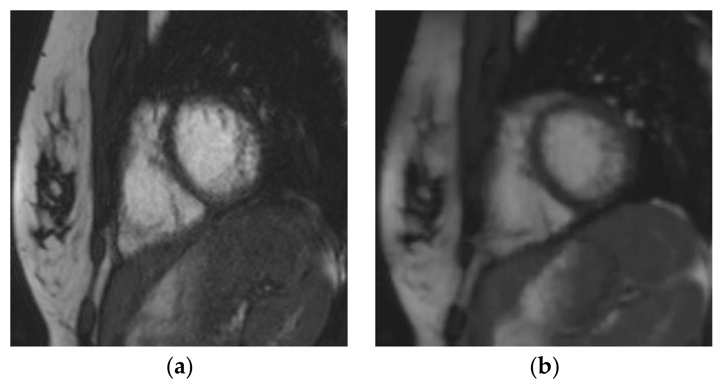 Jcm 10 01930 g003a Jcm 10 01930 g003a