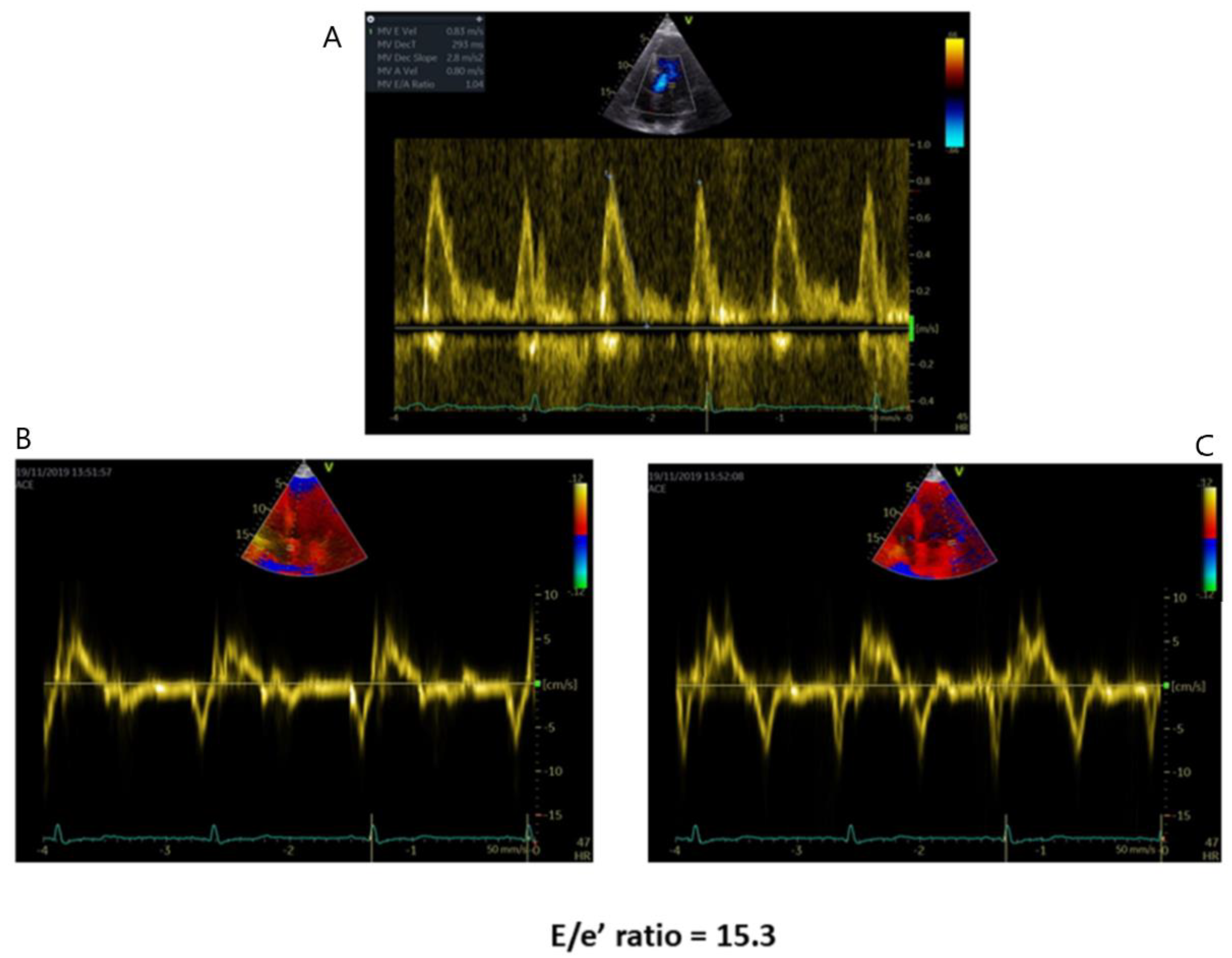 Jcm 10 01994 g002 Jcm 10 01994 g002