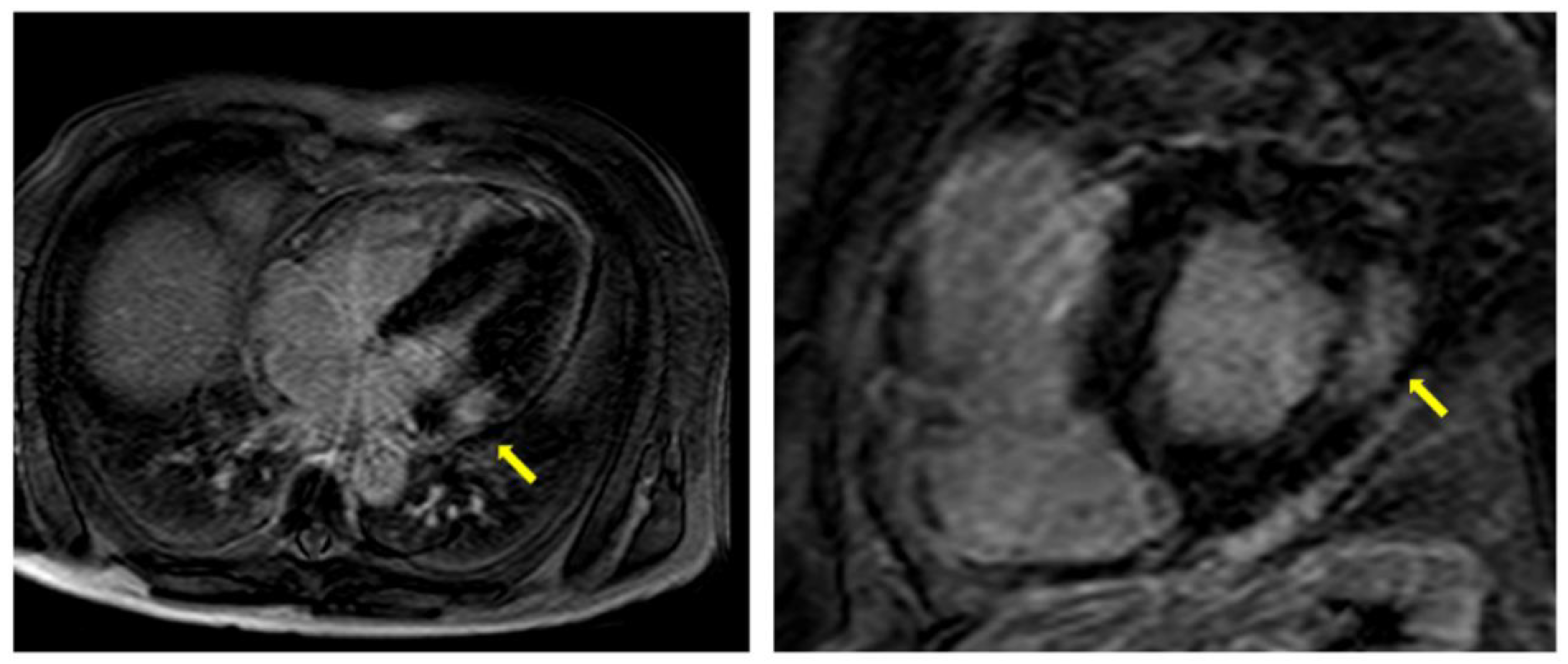 Jcm 10 01994 g006 Jcm 10 01994 g006