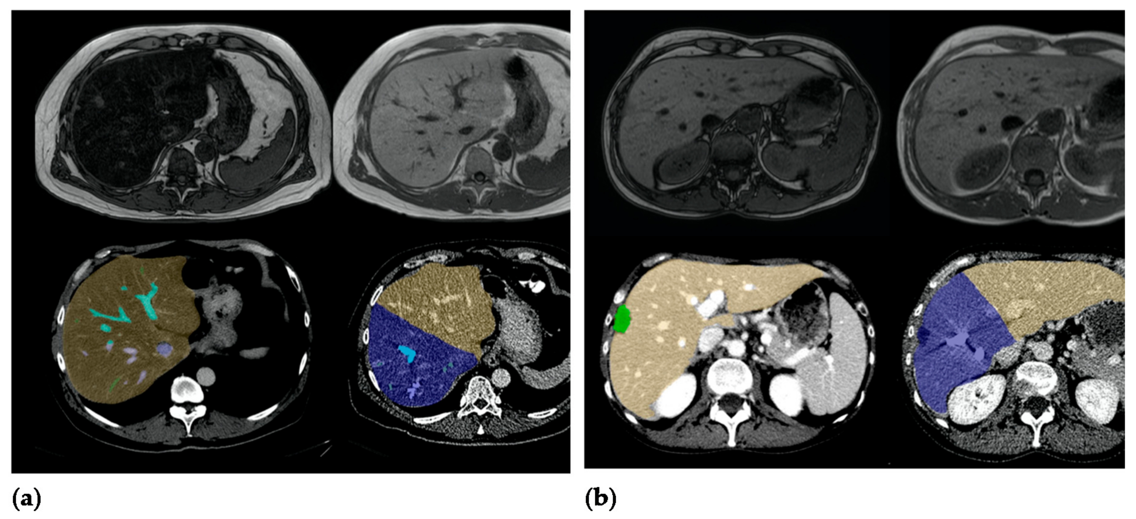 Jcm 10 02003 g002 Jcm 10 02003 g002