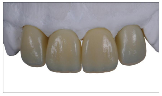 Jcm Free Full Text 3d Printing In Digital Prosthetic Dentistry An Overview Of Recent Developments In Additive Manufacturing Html