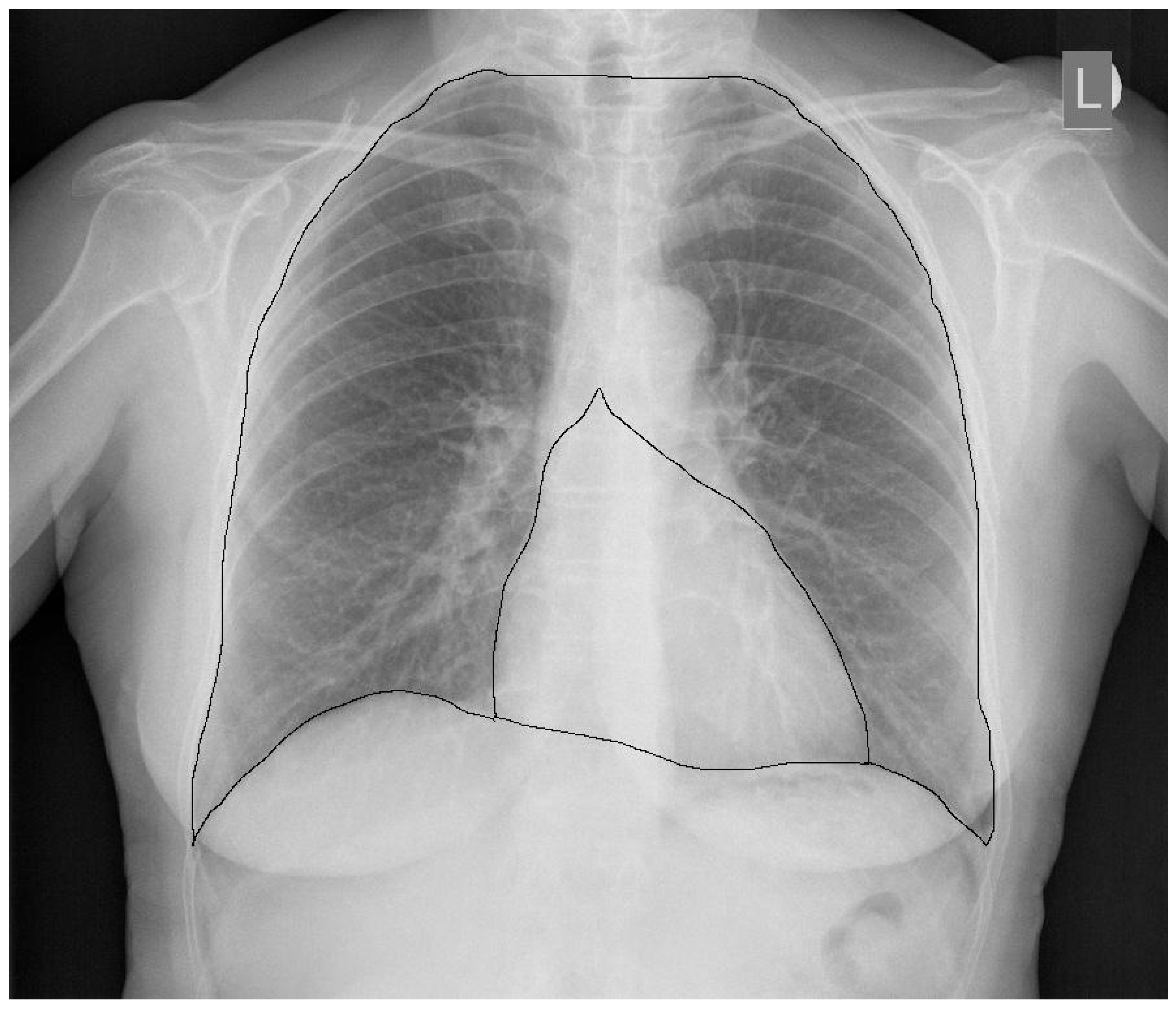 Jcm 10 02016 g003 Jcm 10 02016 g003