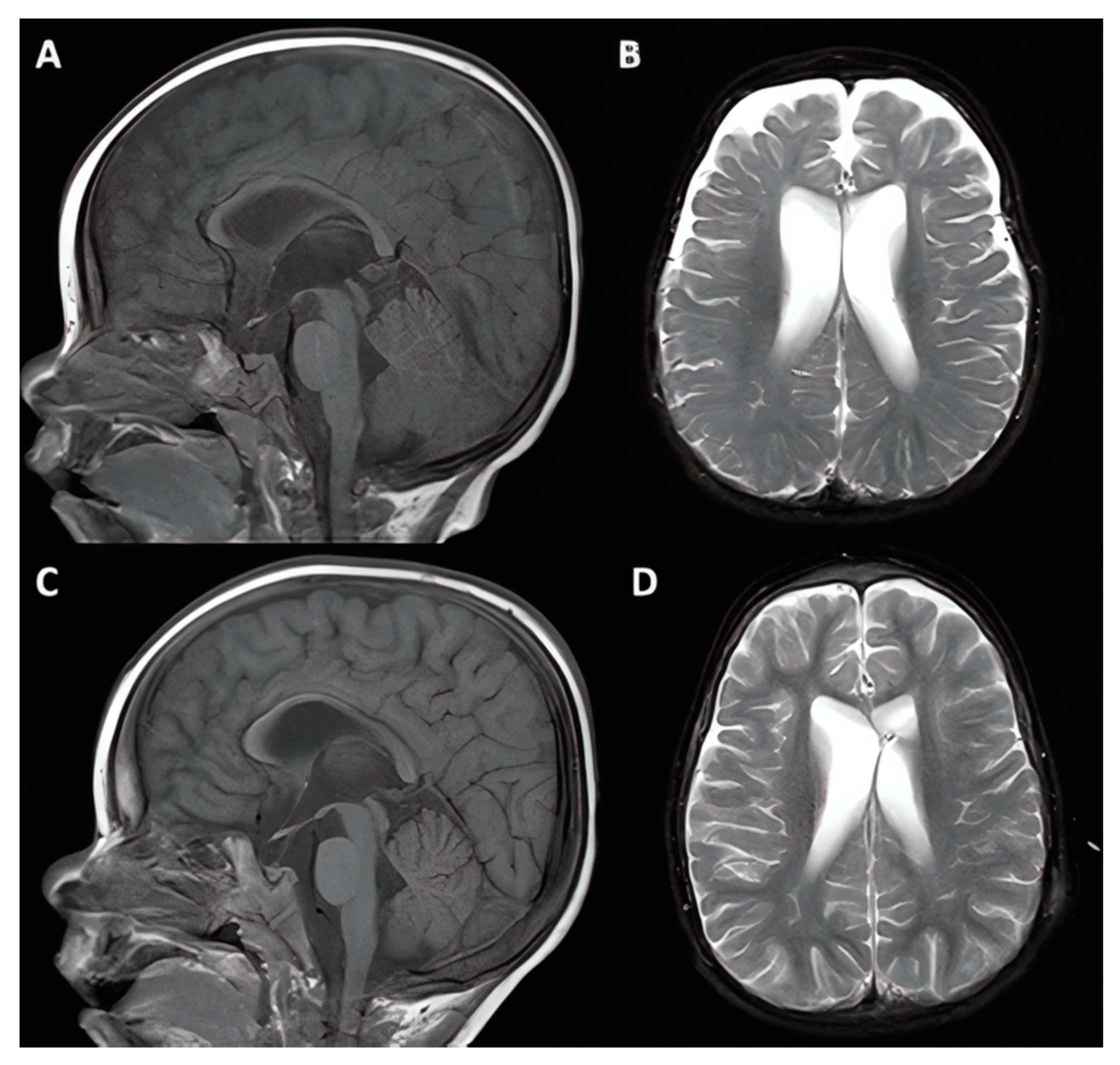 Jcm 10 02026 g003 Jcm 10 02026 g003