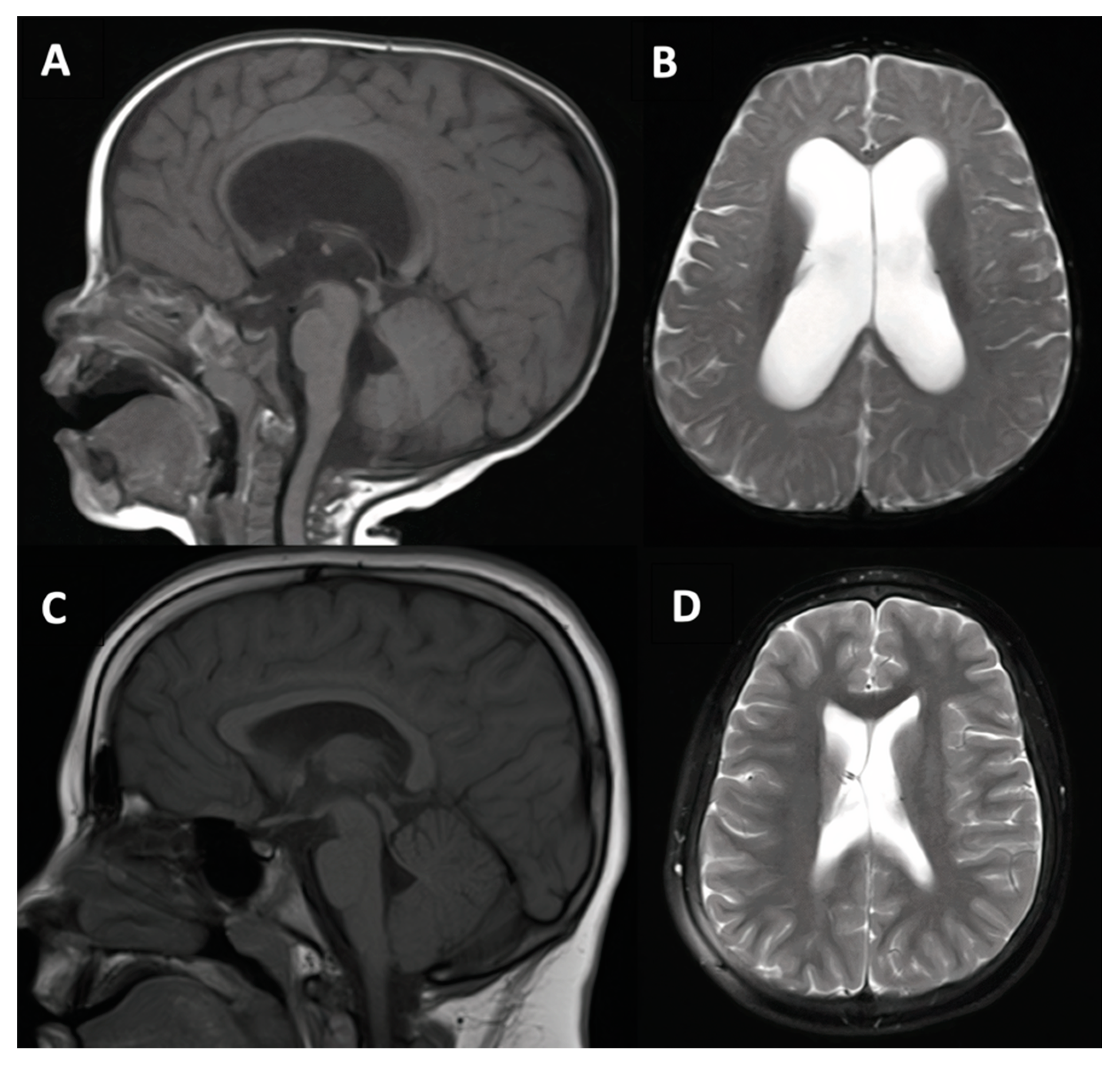 Jcm 10 02026 g004 Jcm 10 02026 g004