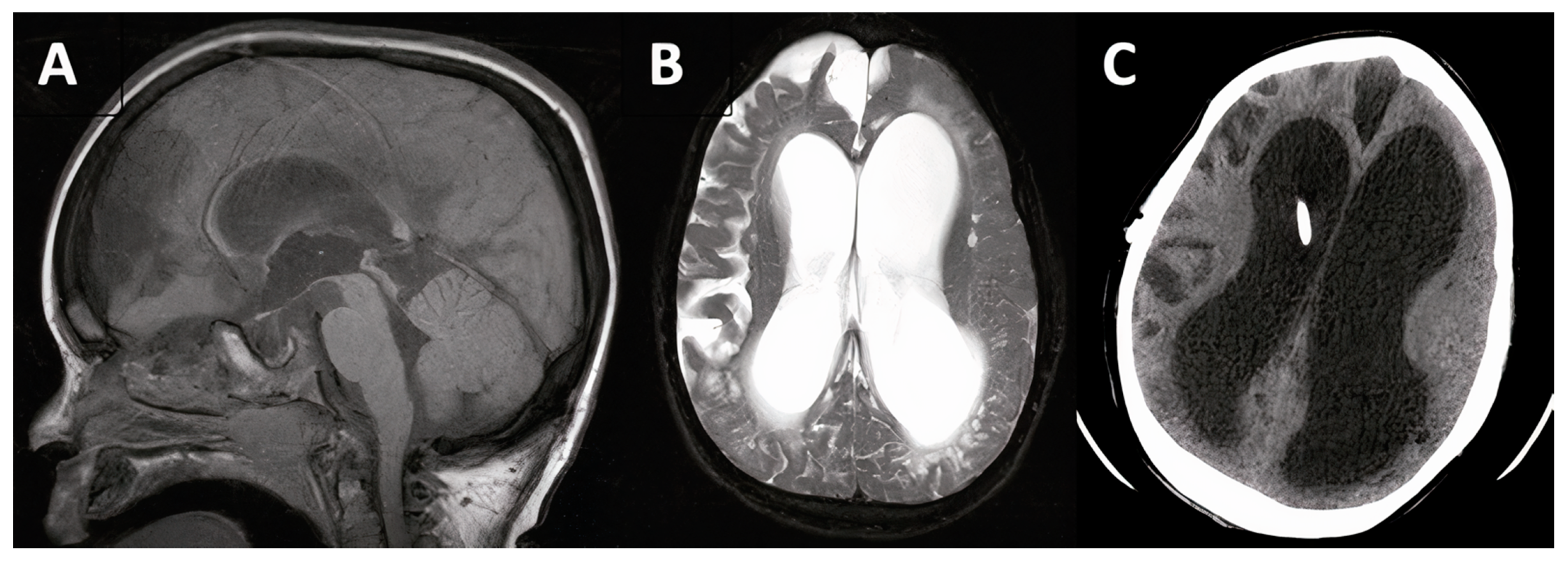 Jcm 10 02026 g005 Jcm 10 02026 g005