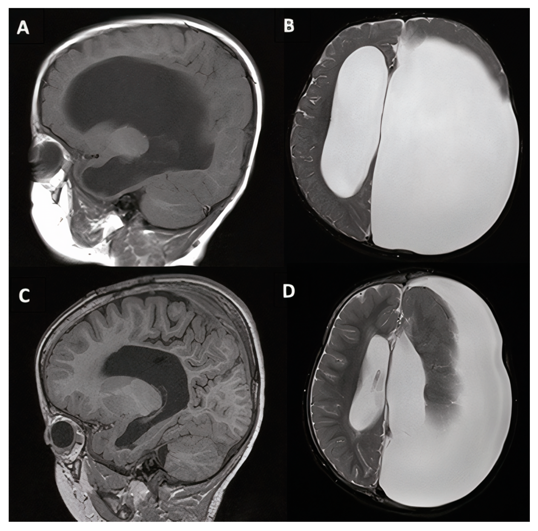 Jcm 10 02026 g006 Jcm 10 02026 g006