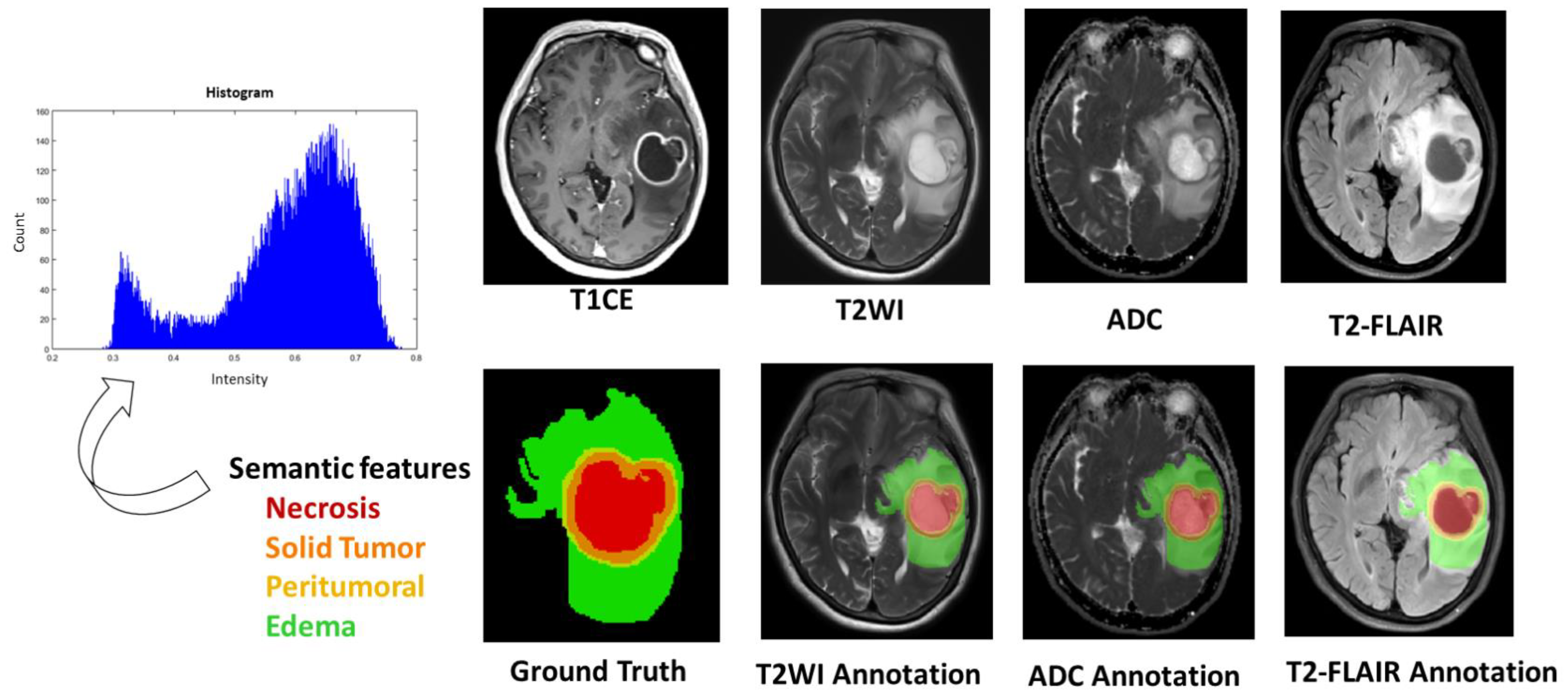 Jcm 10 02030 g004 Jcm 10 02030 g004