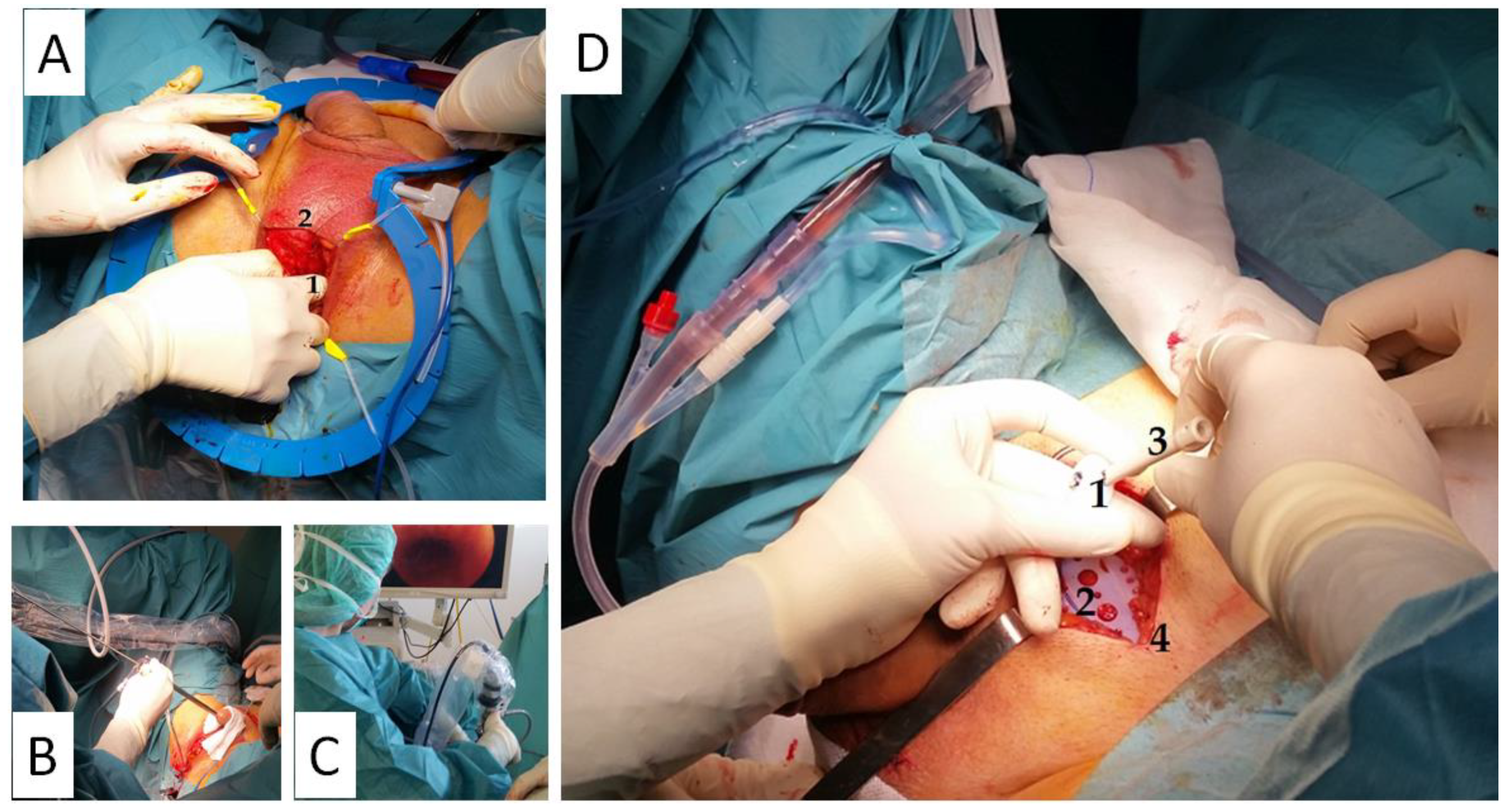 Jcm 10 02121 g002 550