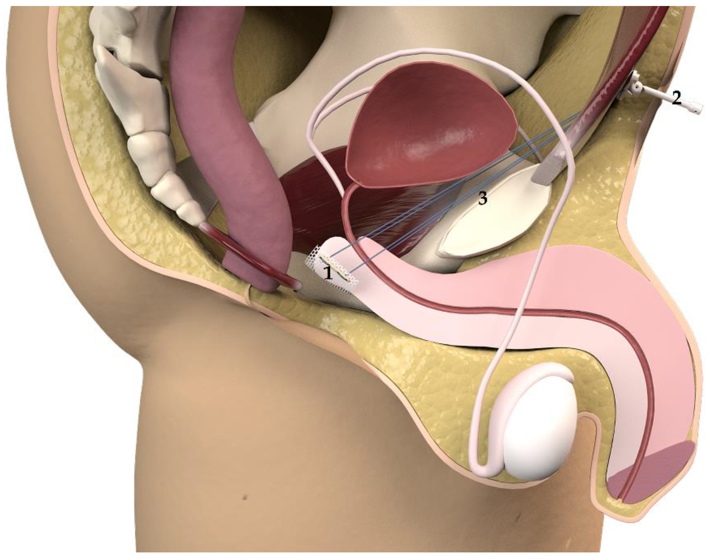 Jcm 10 02121 g003 550