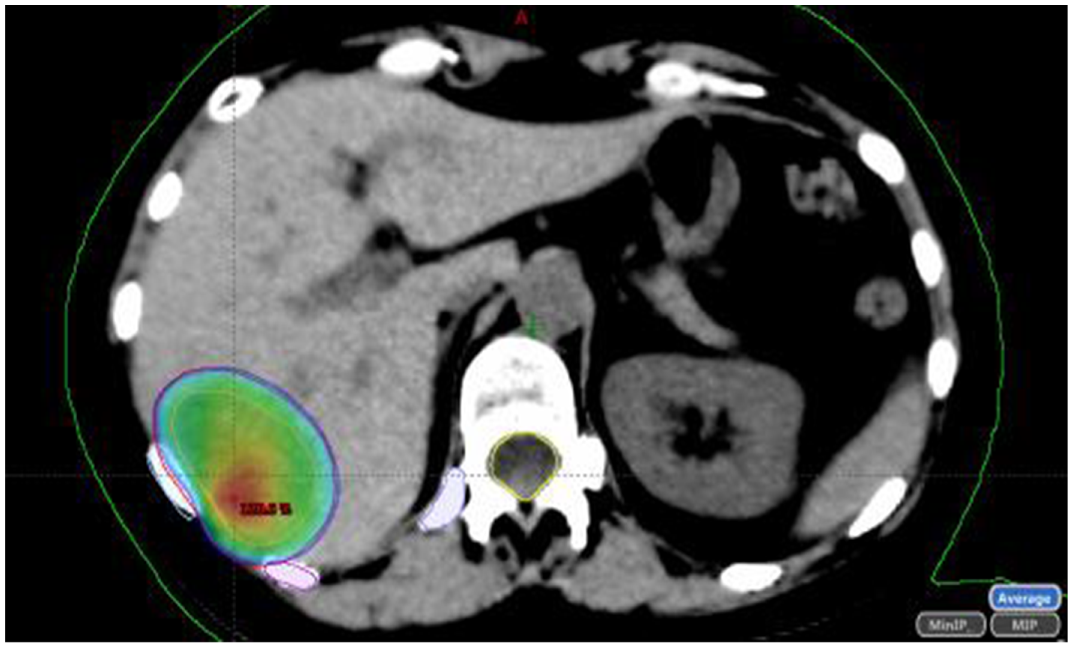 Jcm 10 02131 g002 Jcm 10 02131 g002