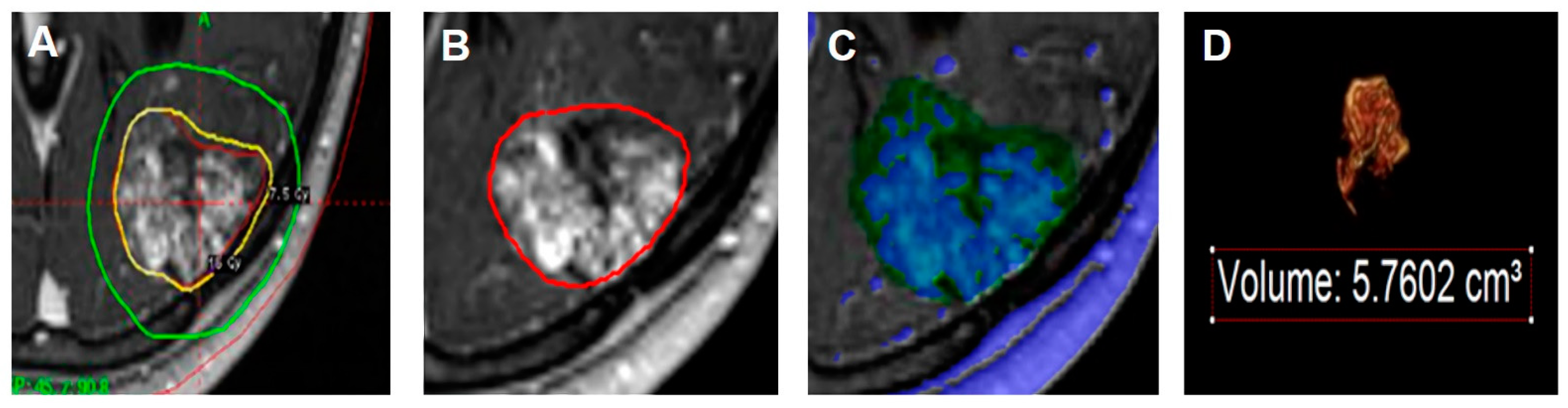 nabe190 MALFORMED / Confinement of＋3枚 nabe190 MALFORMED / Confinement of＋3枚 Confinement of Flesh