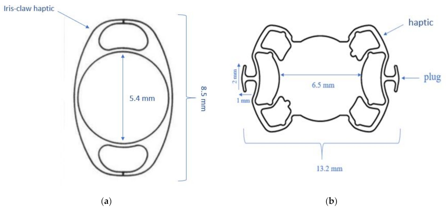 JCM Free FullText Secondary Sutureless Posterior Chamber Lens