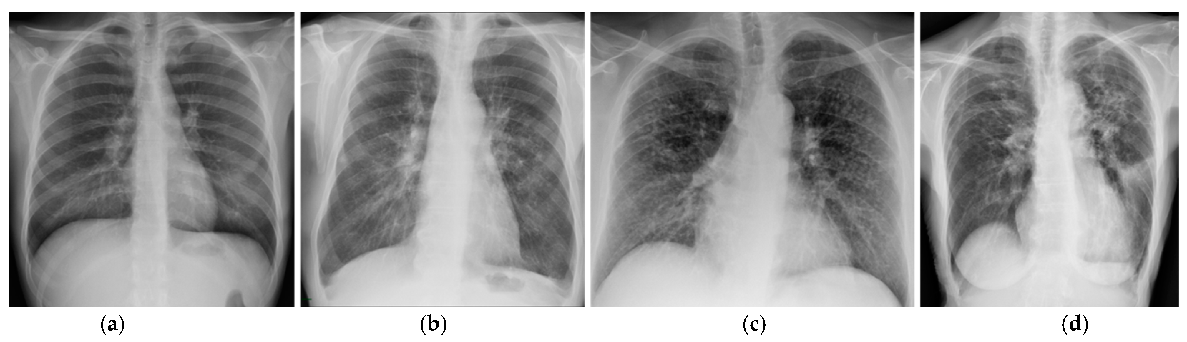 Jcm 10 02222 g003 Jcm 10 02222 g003