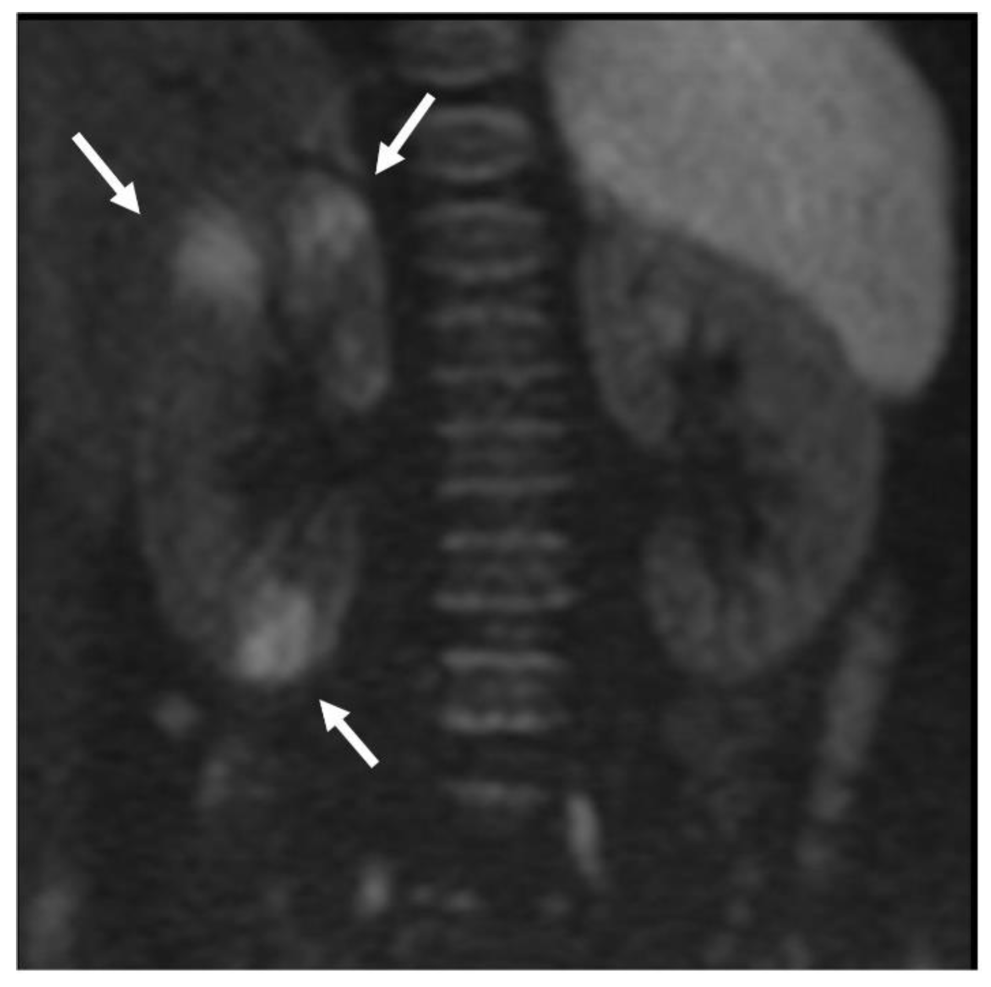 Jcm 10 02239 g002 Jcm 10 02239 g002