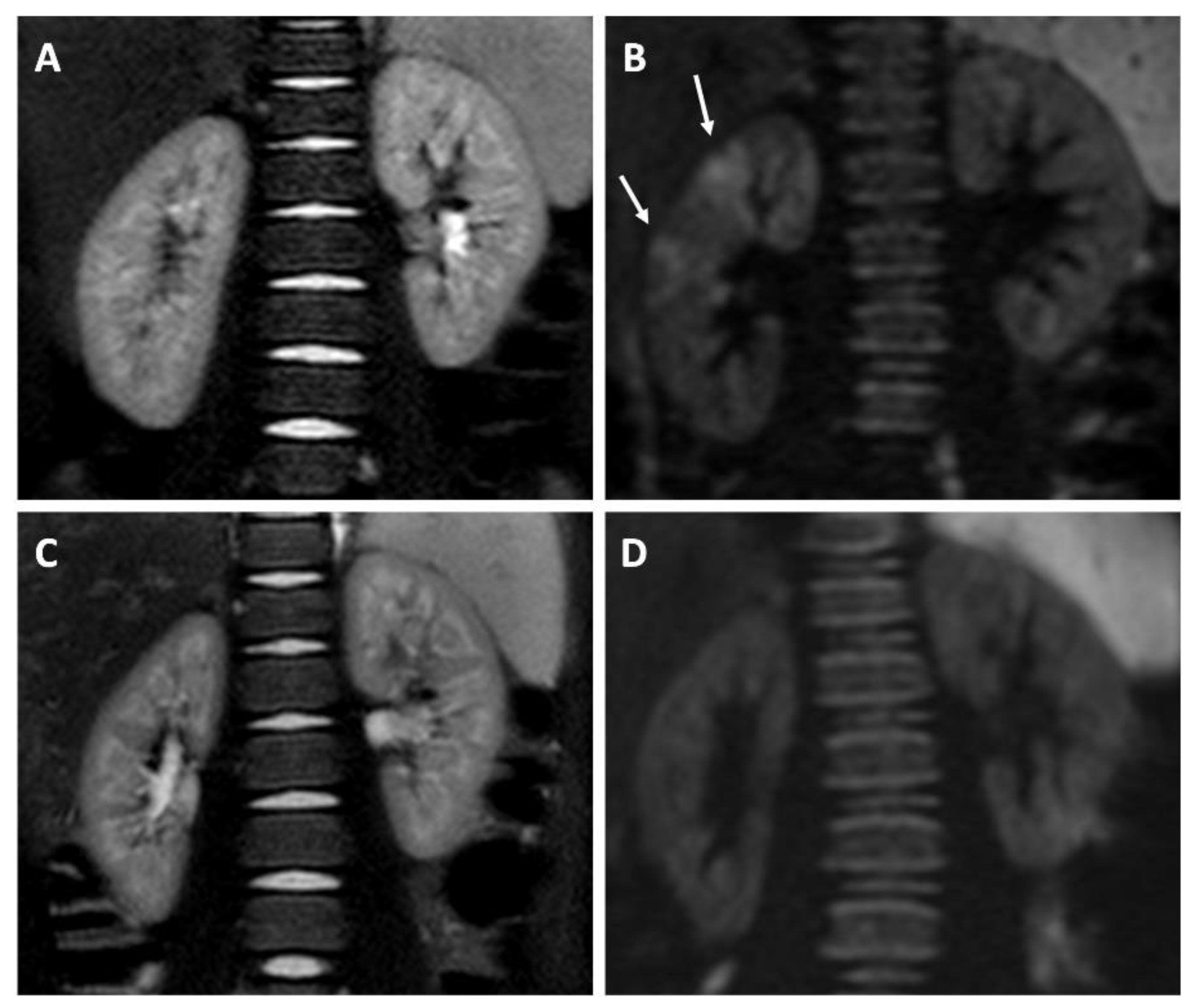 Jcm 10 02239 g003 Jcm 10 02239 g003